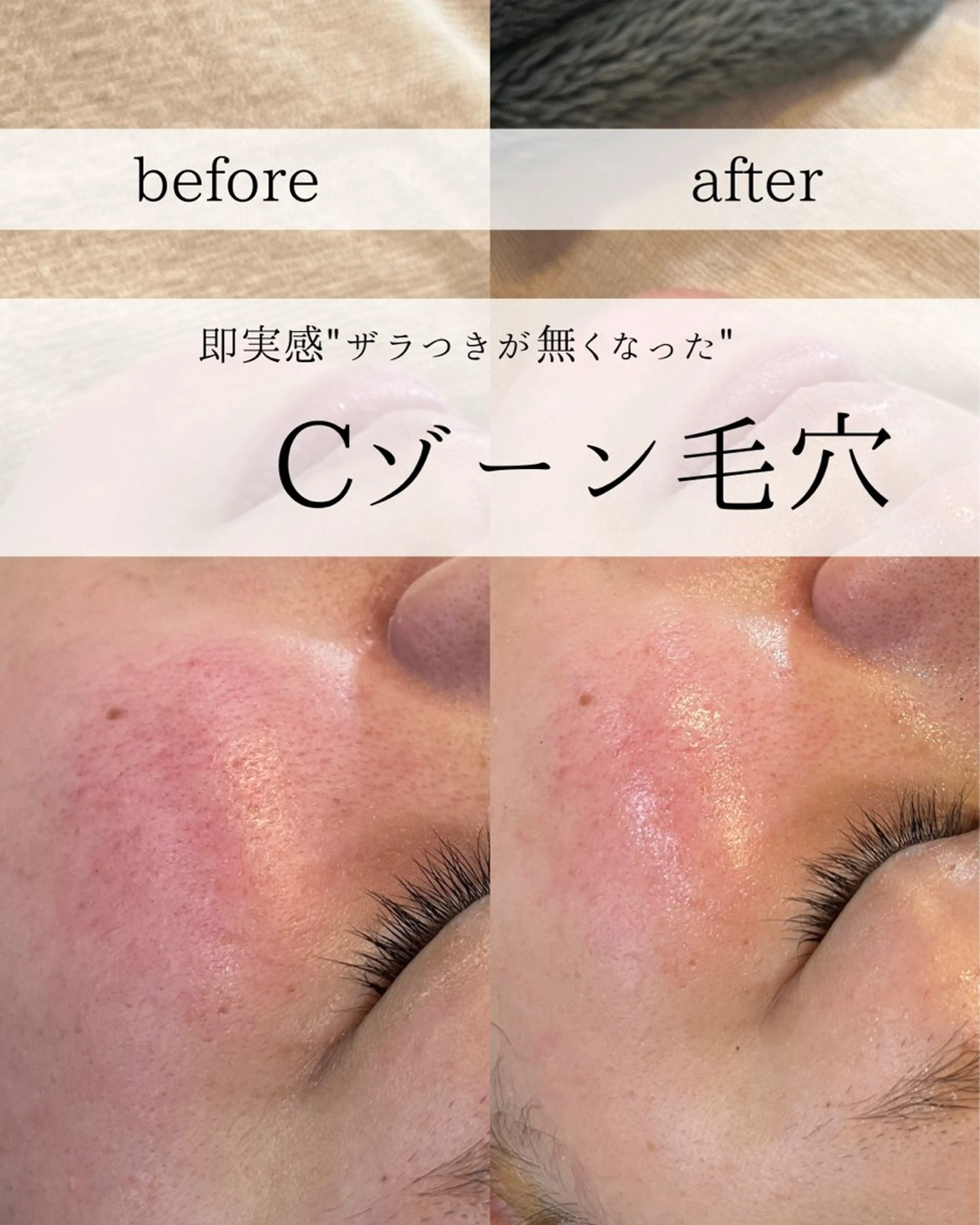 yc.hacci 【ハーブピーリング】の眉毛・アイブロウイメージ