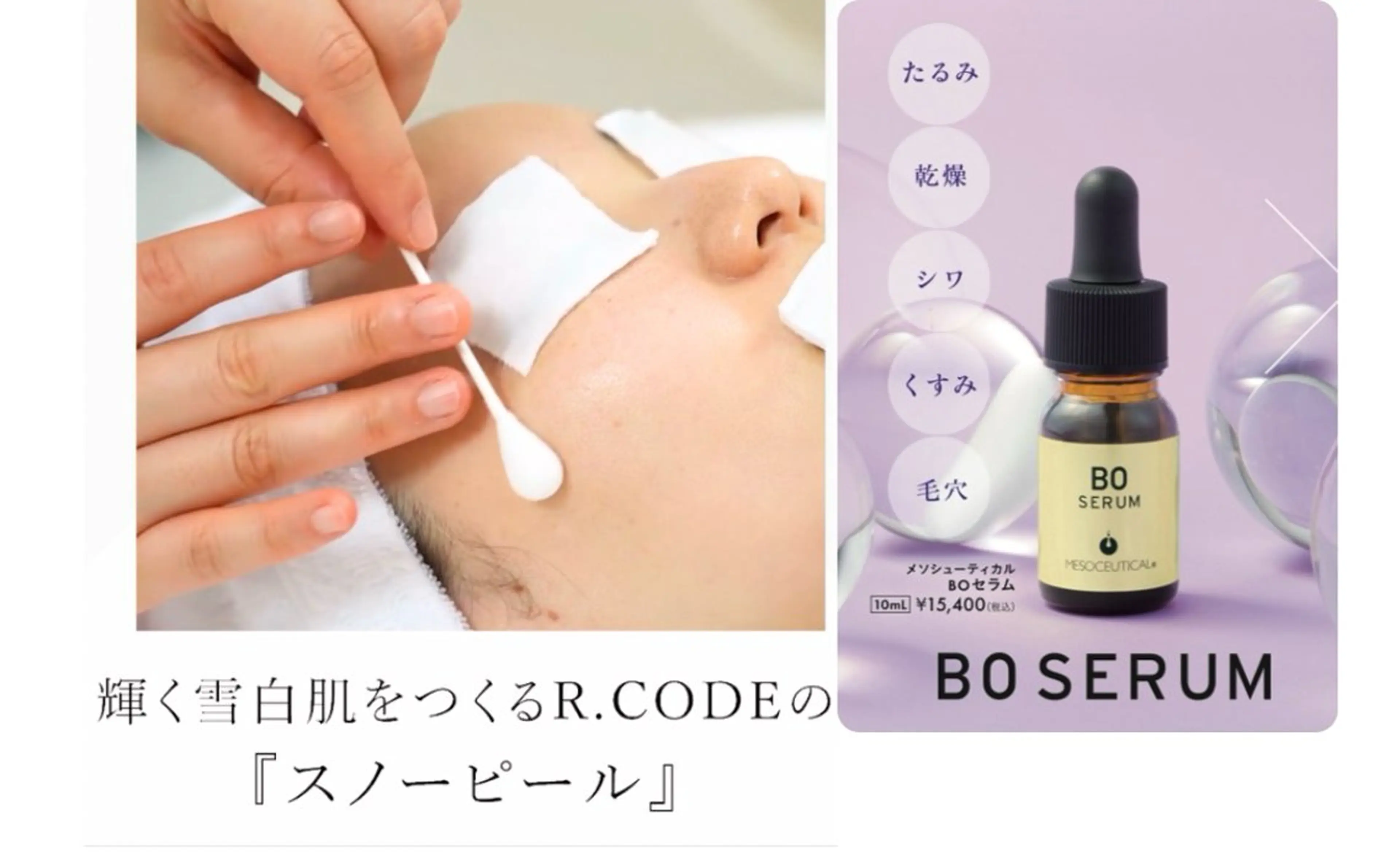 【ミニモ限定】ホワイトスノーピール＋しわケアBOセラム（ホームケア用美容液付き）✨の写真