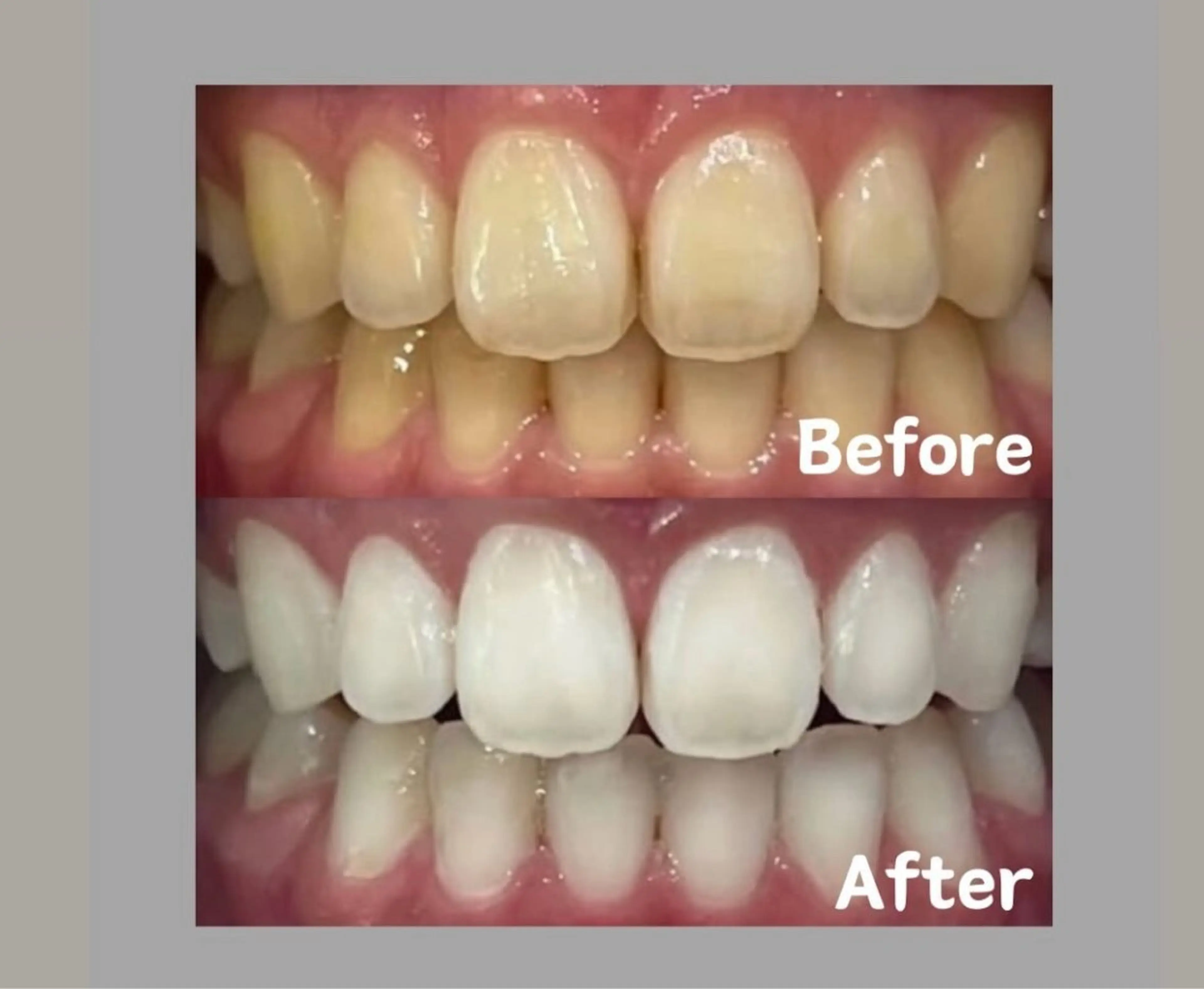 Kaula所属・Kaula ホワイトニング🦷✨のエステ・リラクイメージ