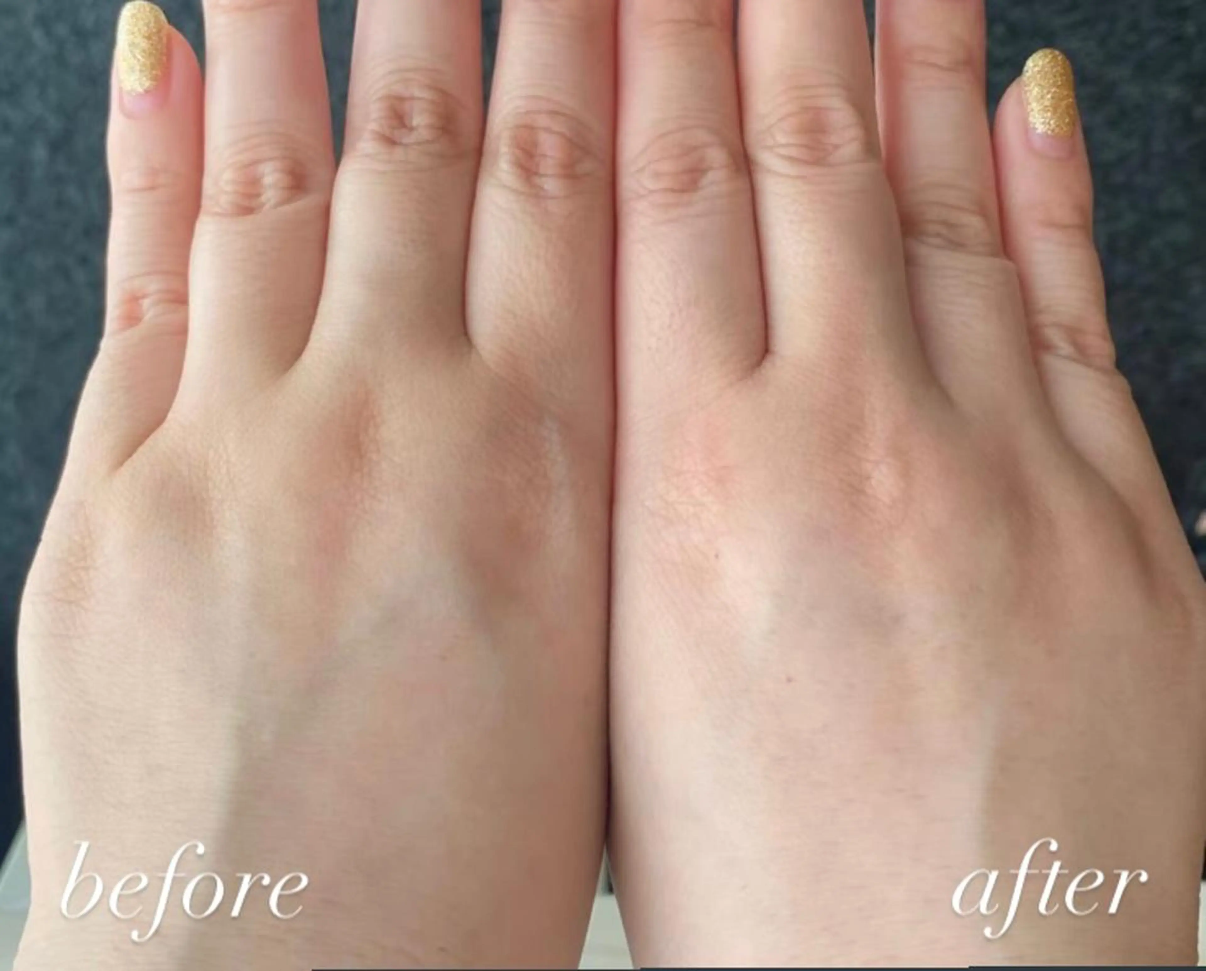 韓国/ピーリング 毛穴洗浄/POLAのエステ・リラクイメージ