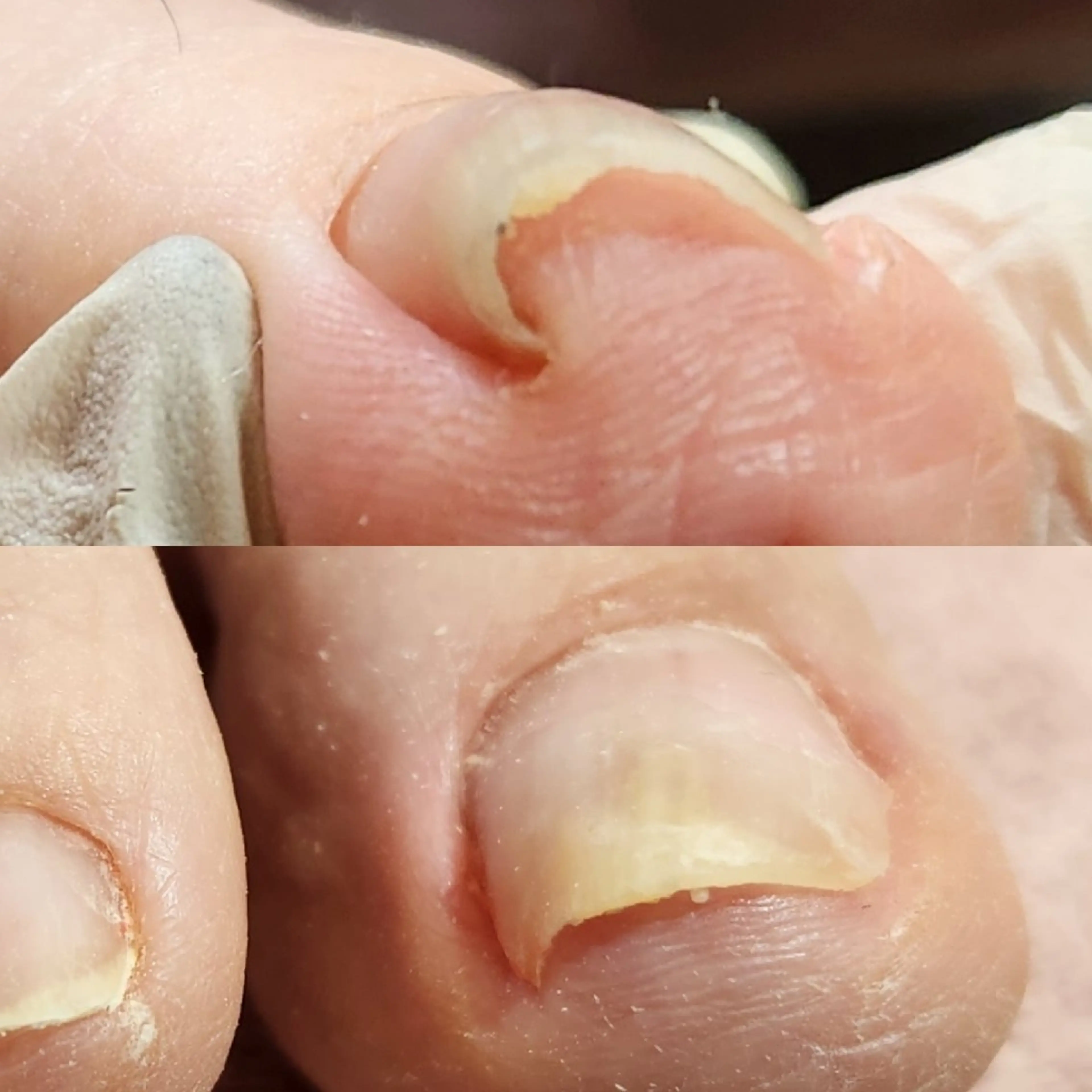 ネイル Micky nail chikushinoのその他イメージ