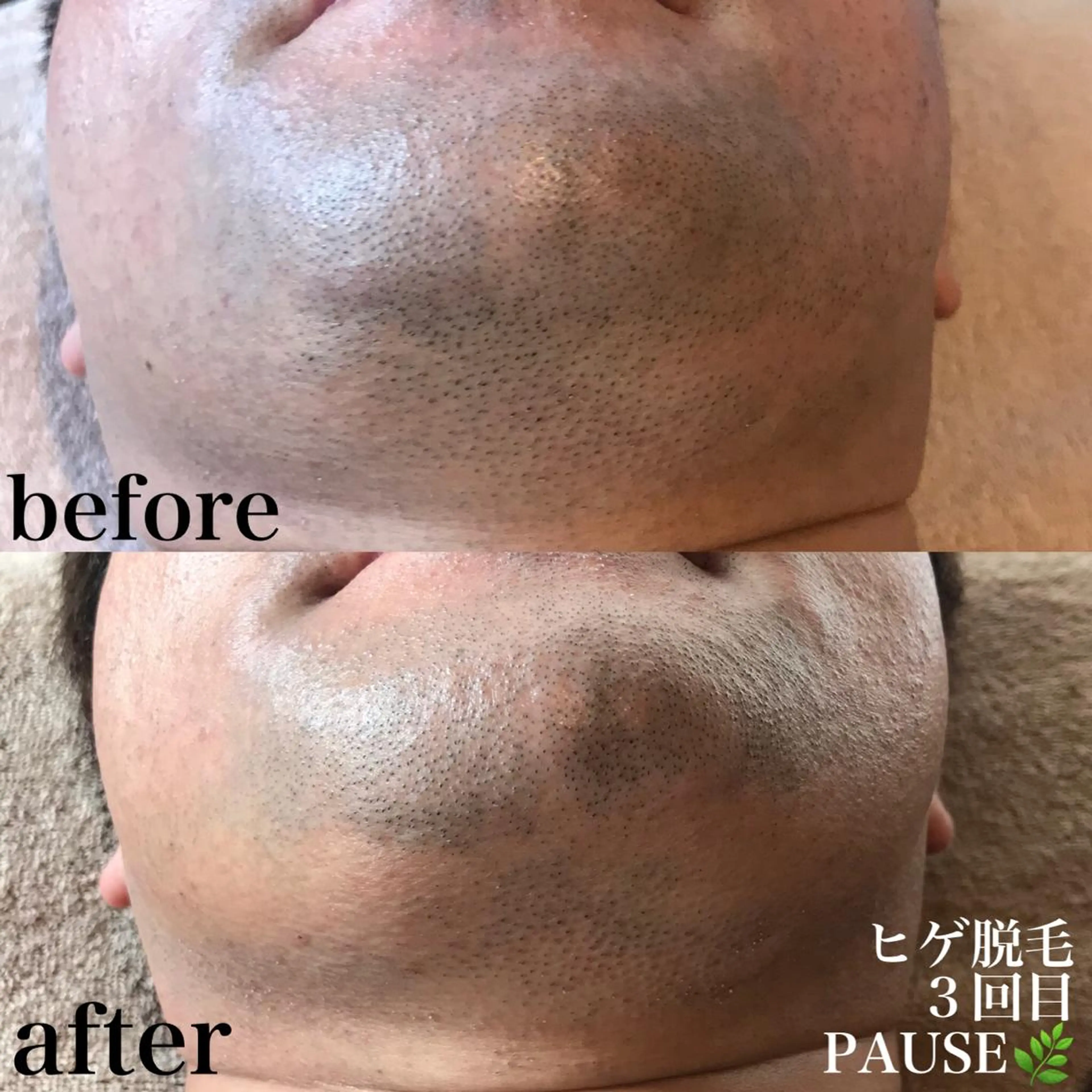 脱毛 浜野 恵美のエステ・リラクイメージ