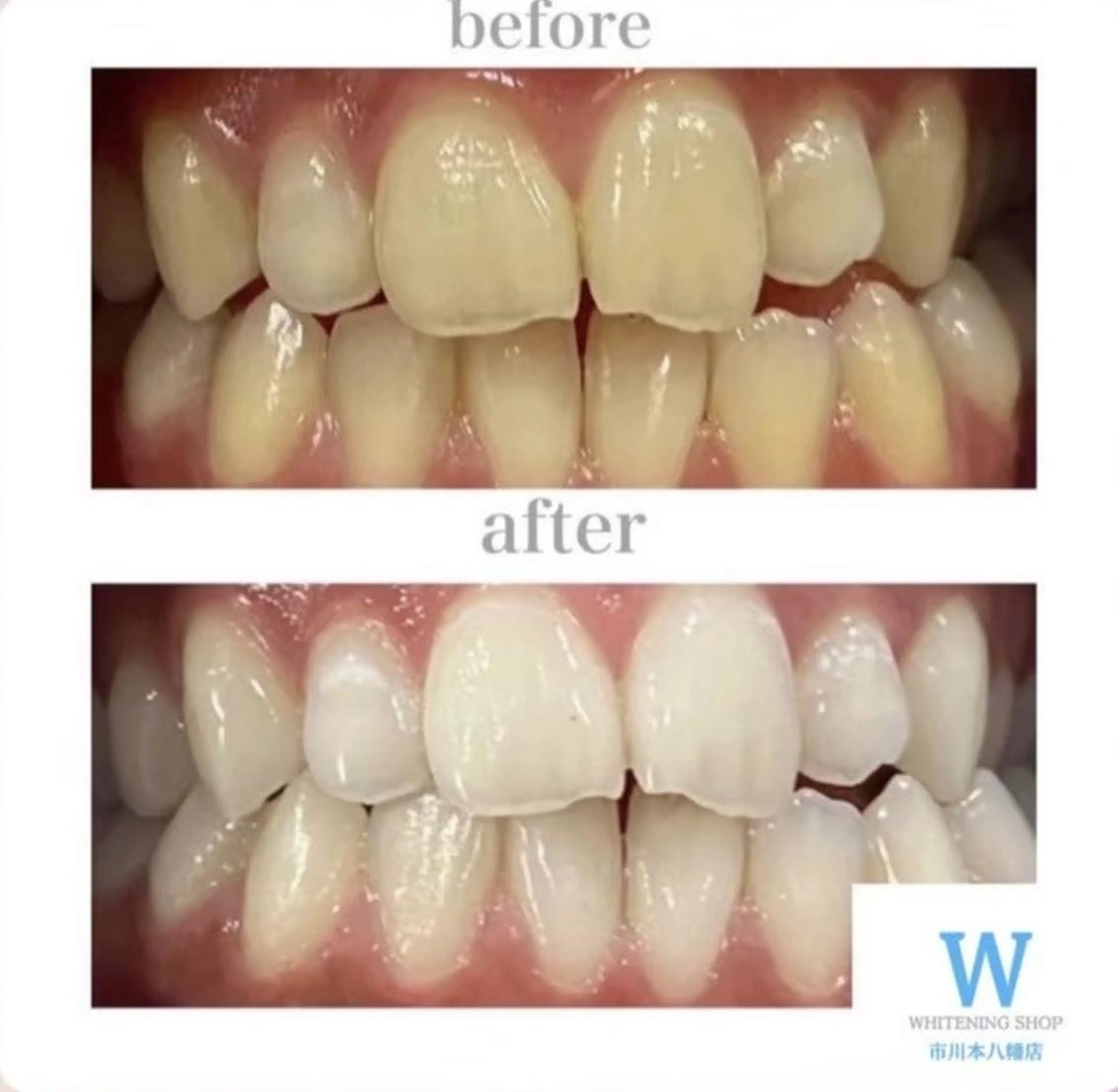 メンズ エステ リラク ホワイトニング ショップ本八幡店のエステ・リラクイメージ