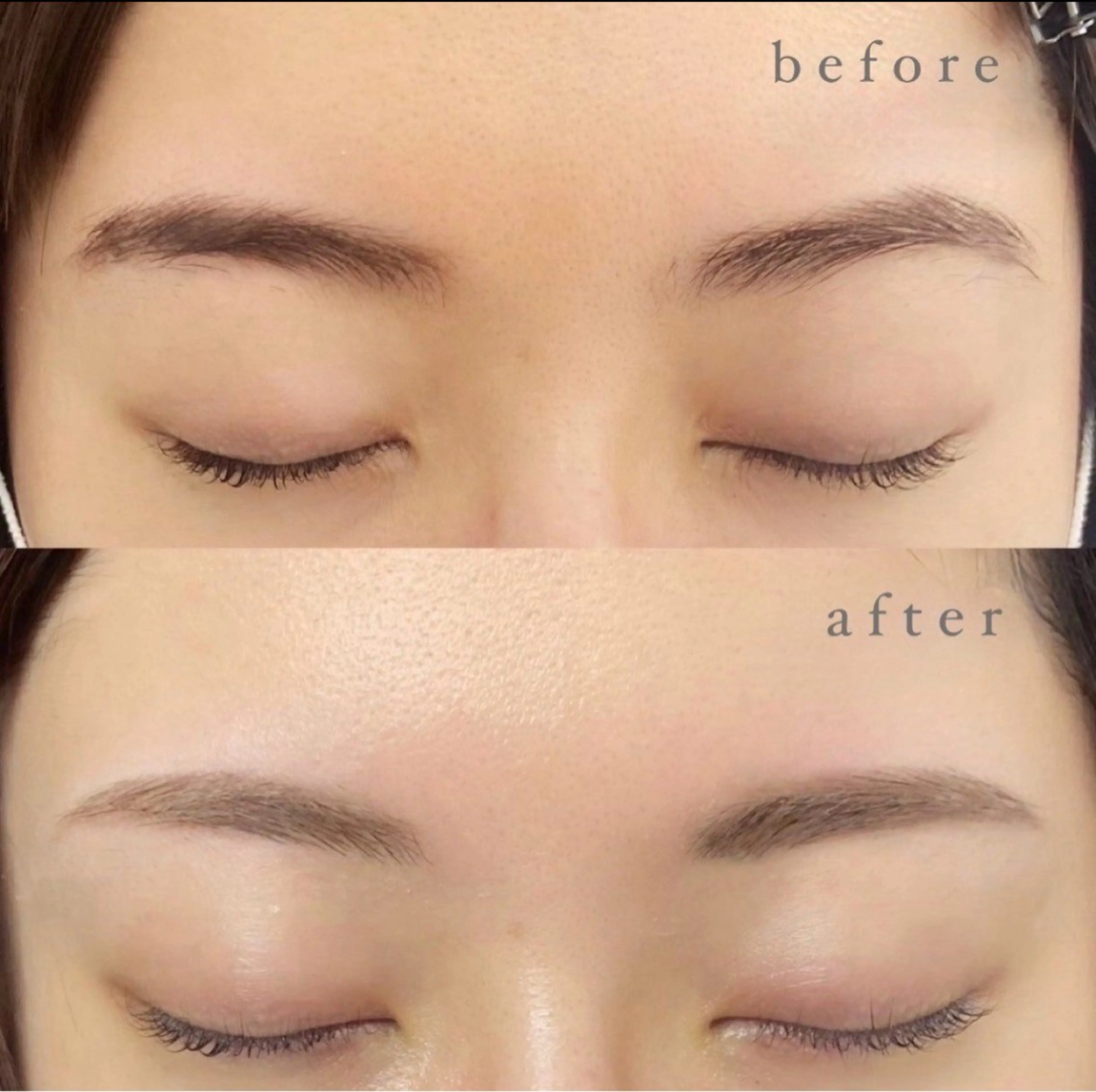 \美眉ワックス脱毛&間引きセット/ before  afterの写真撮影とSNS掲載可能な方限定⚠️注意事項必読⚠️の写真