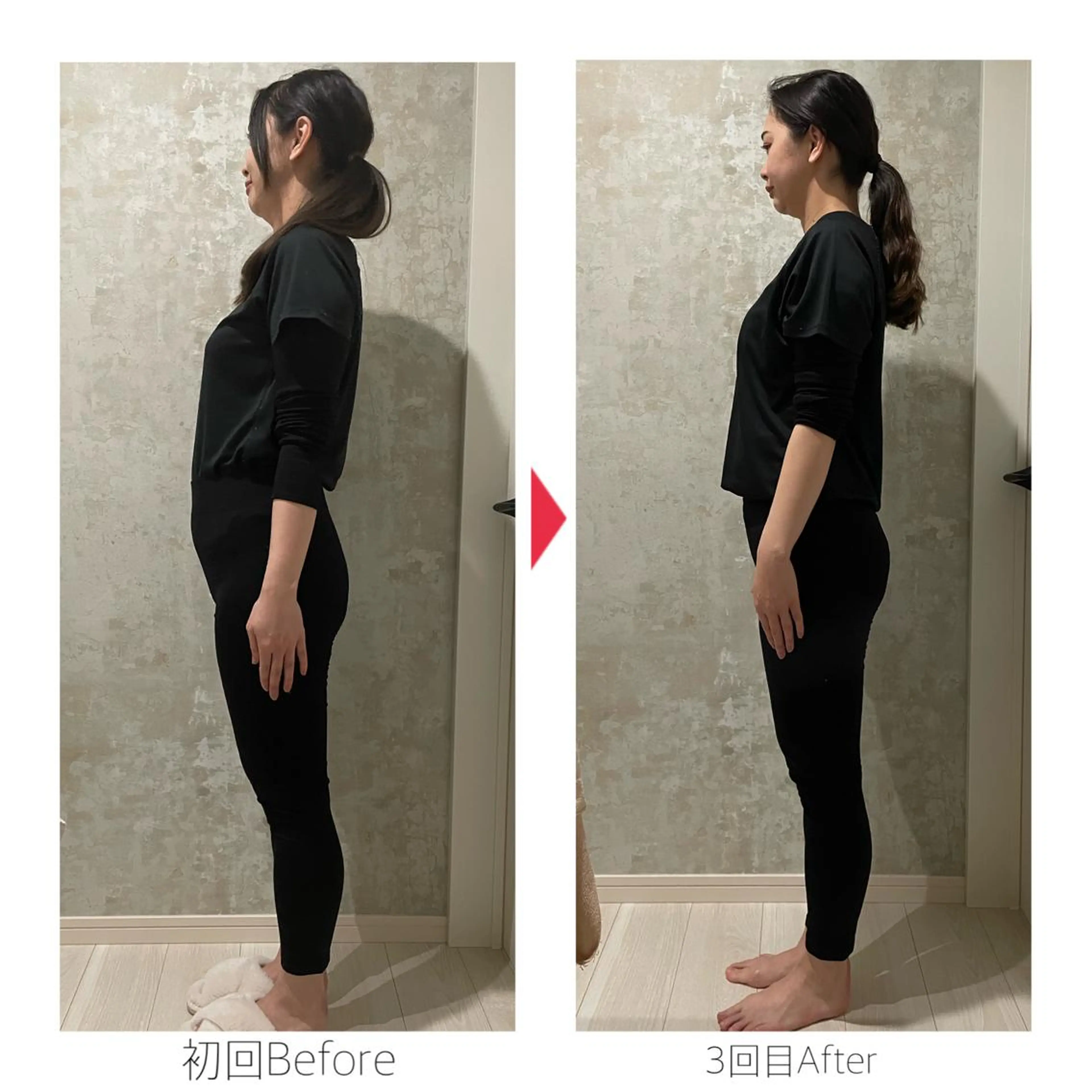 OREO式美容整体の写真