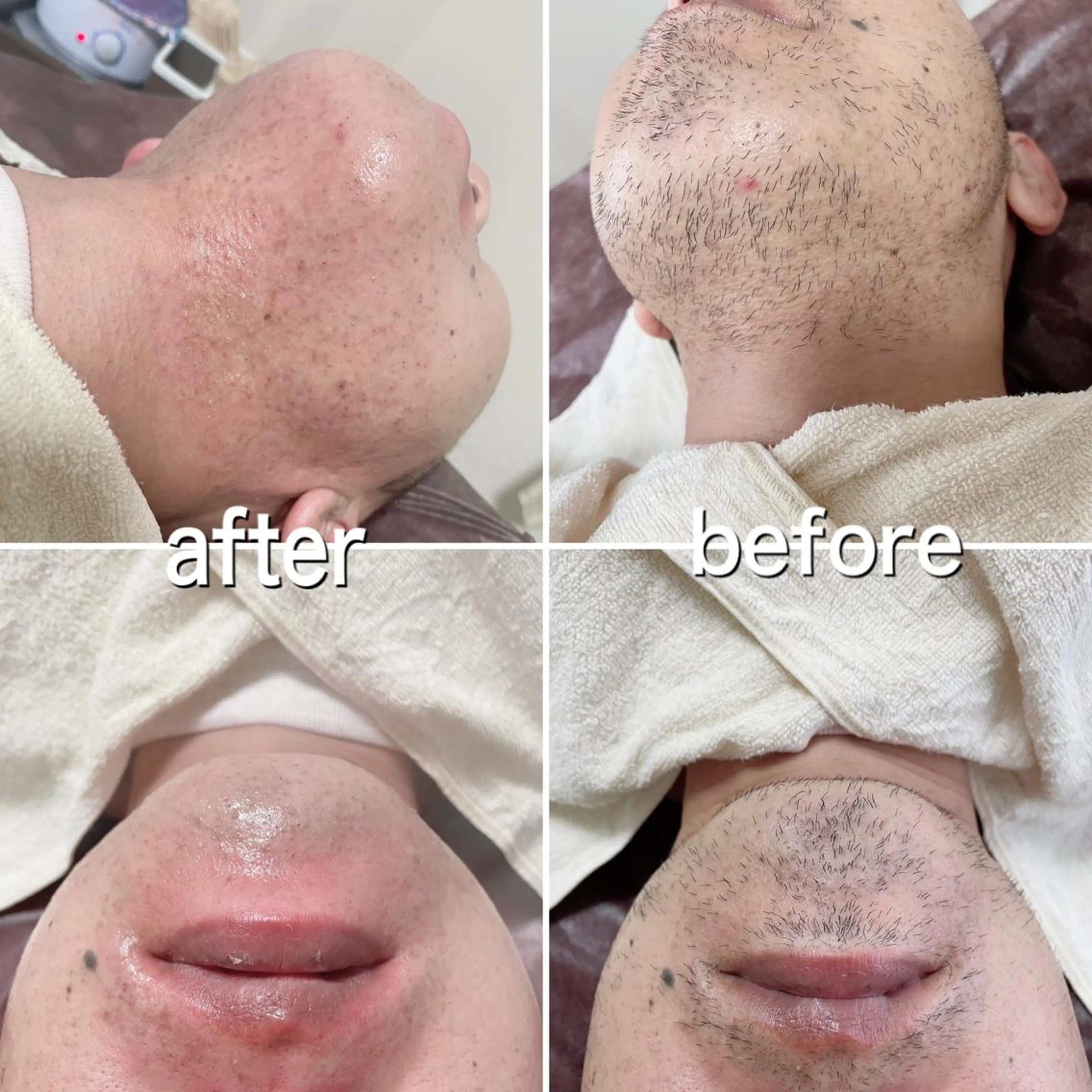 メンズ 濱田 美菜子のエステ・リラクイメージ