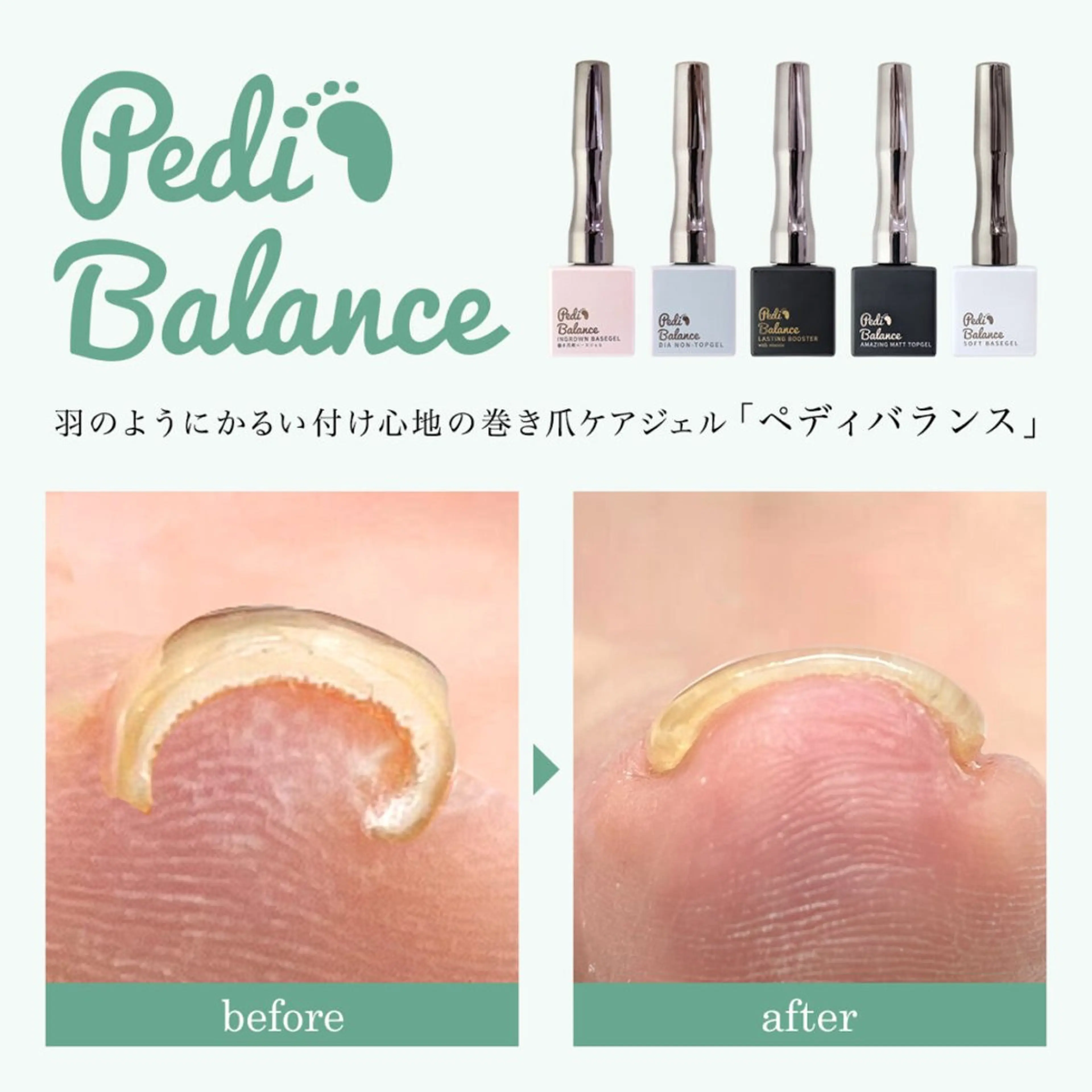 ネイル フットネイル Blue daisy RIN🎀のネイルデザイン