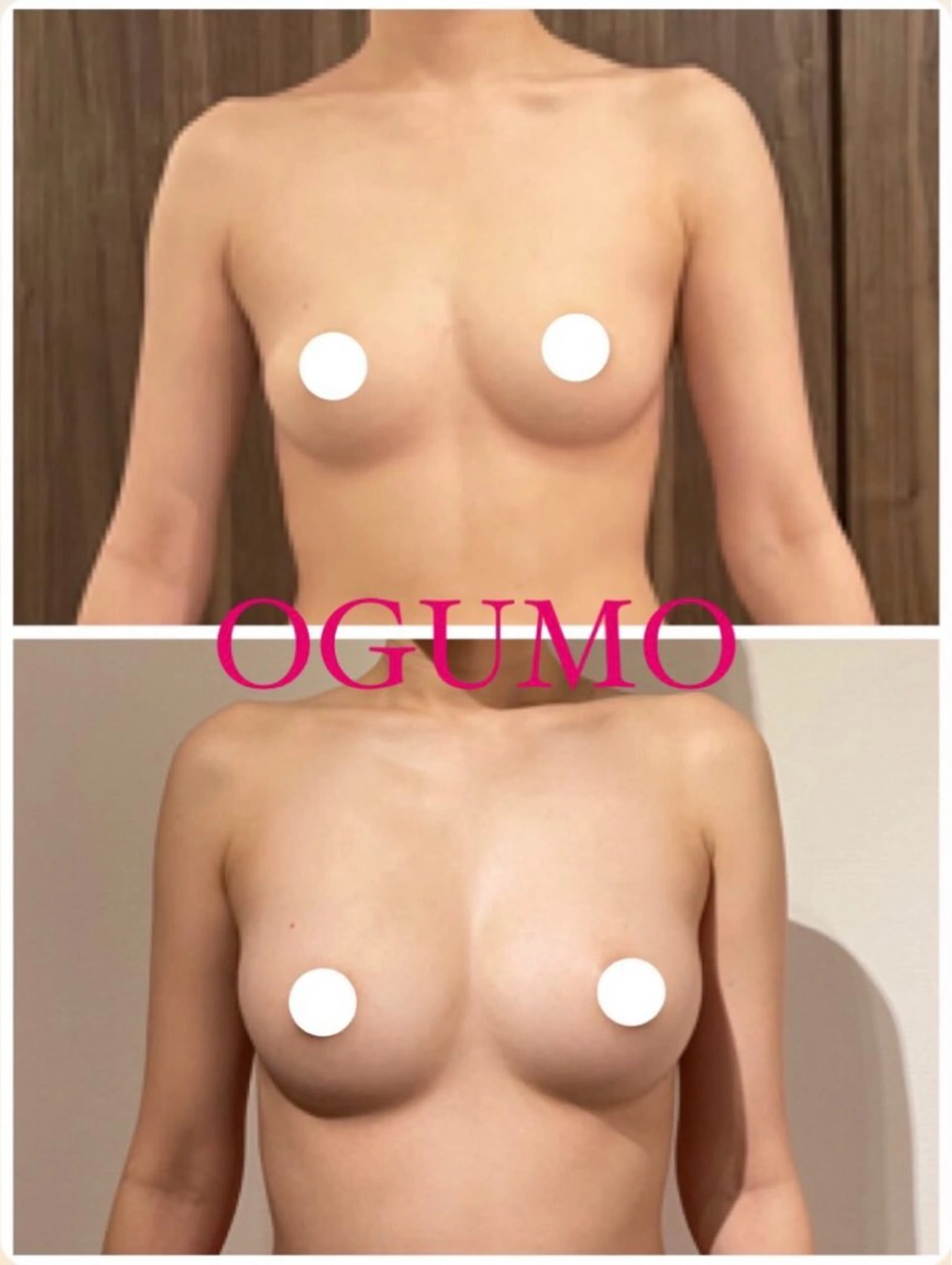 肌管理 OGUMOのエステ・リラクイメージ