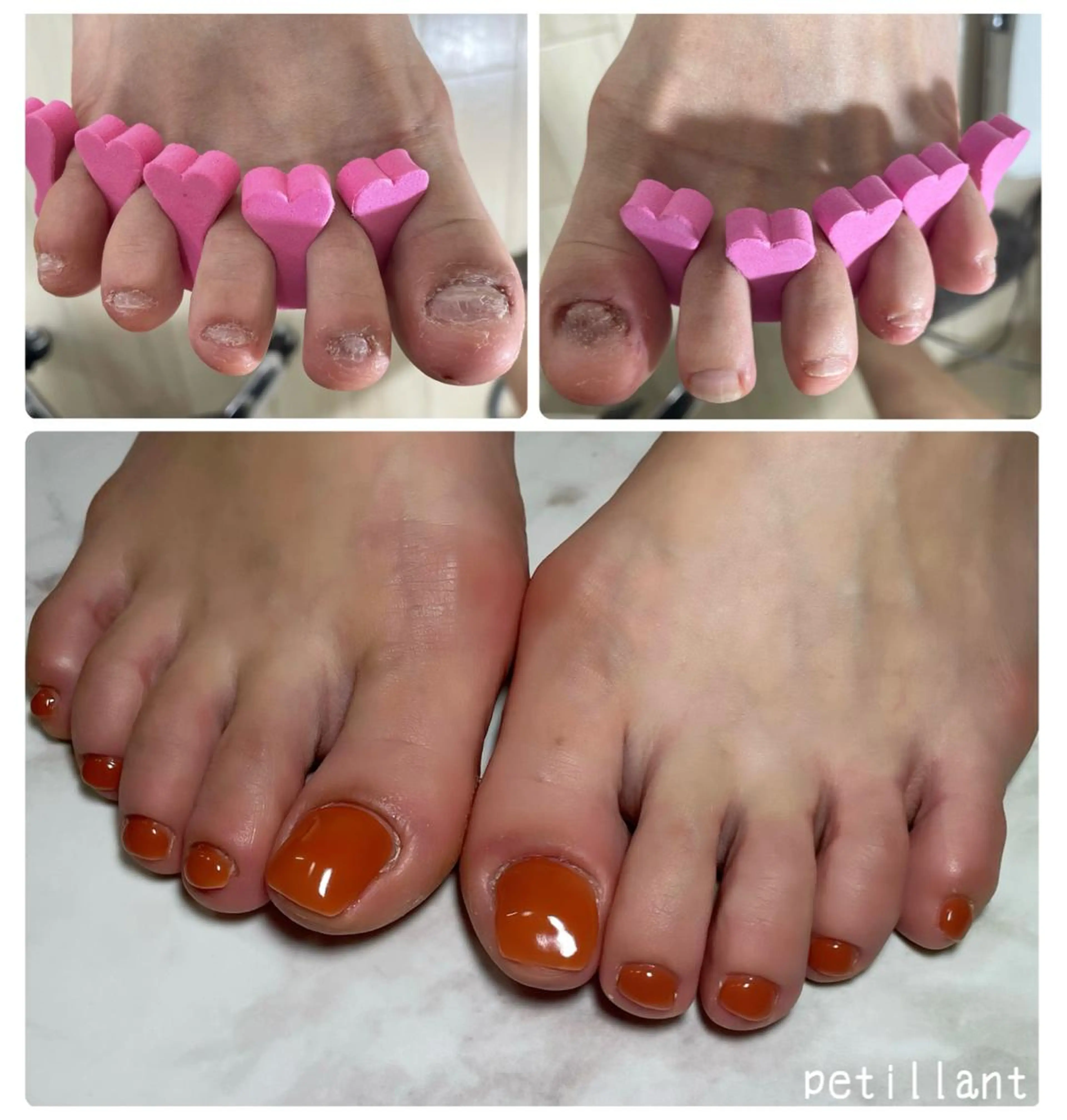 ネイル フットネイル ジェルネイル nail salon petillantのネイルデザイン