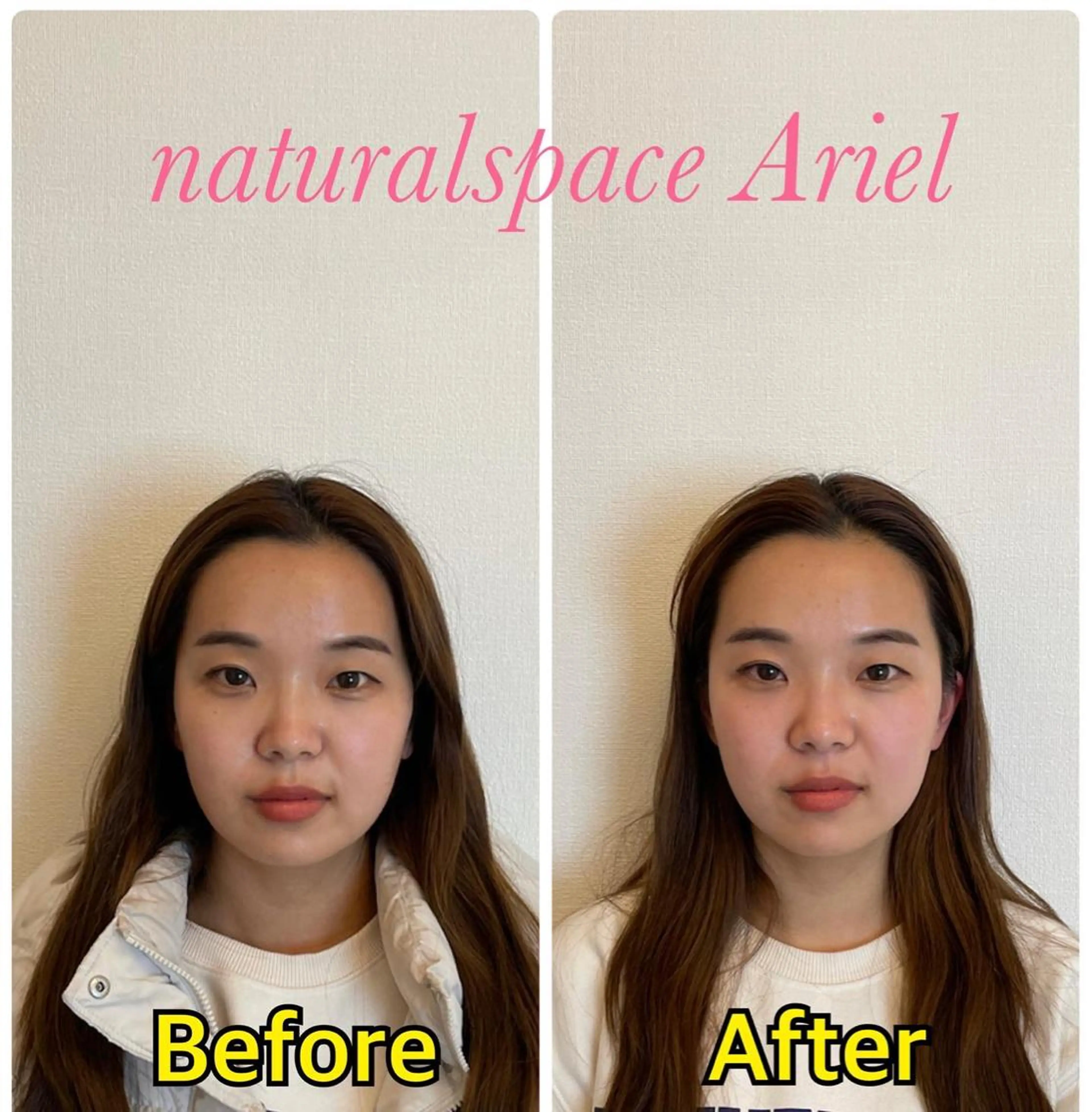 町田・鶴川 小顔矯正 /鈴木友実のエステ・リラクイメージ