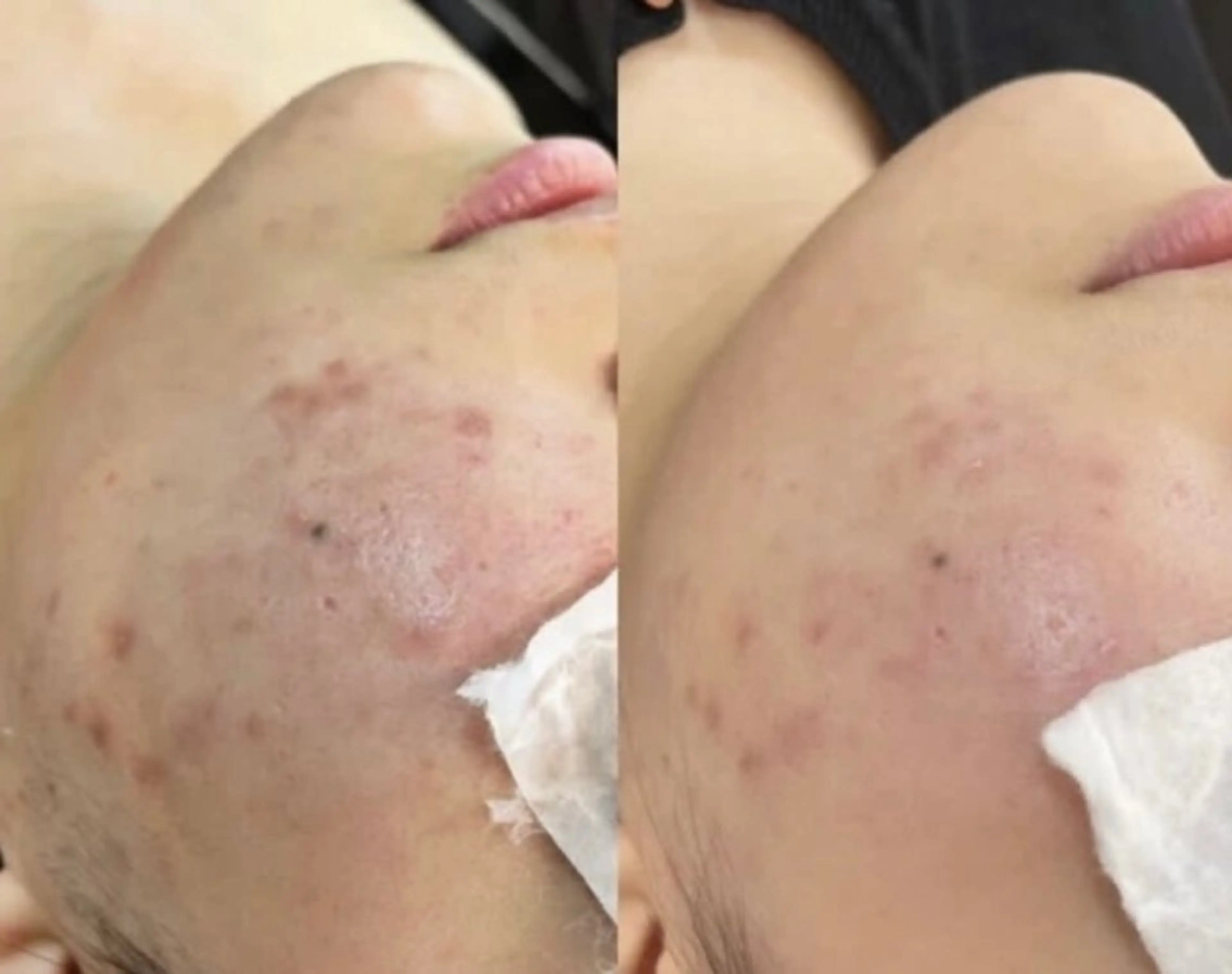 エステ 最速小顔・肌質管理 espoirマキのエステ・リラクイメージ