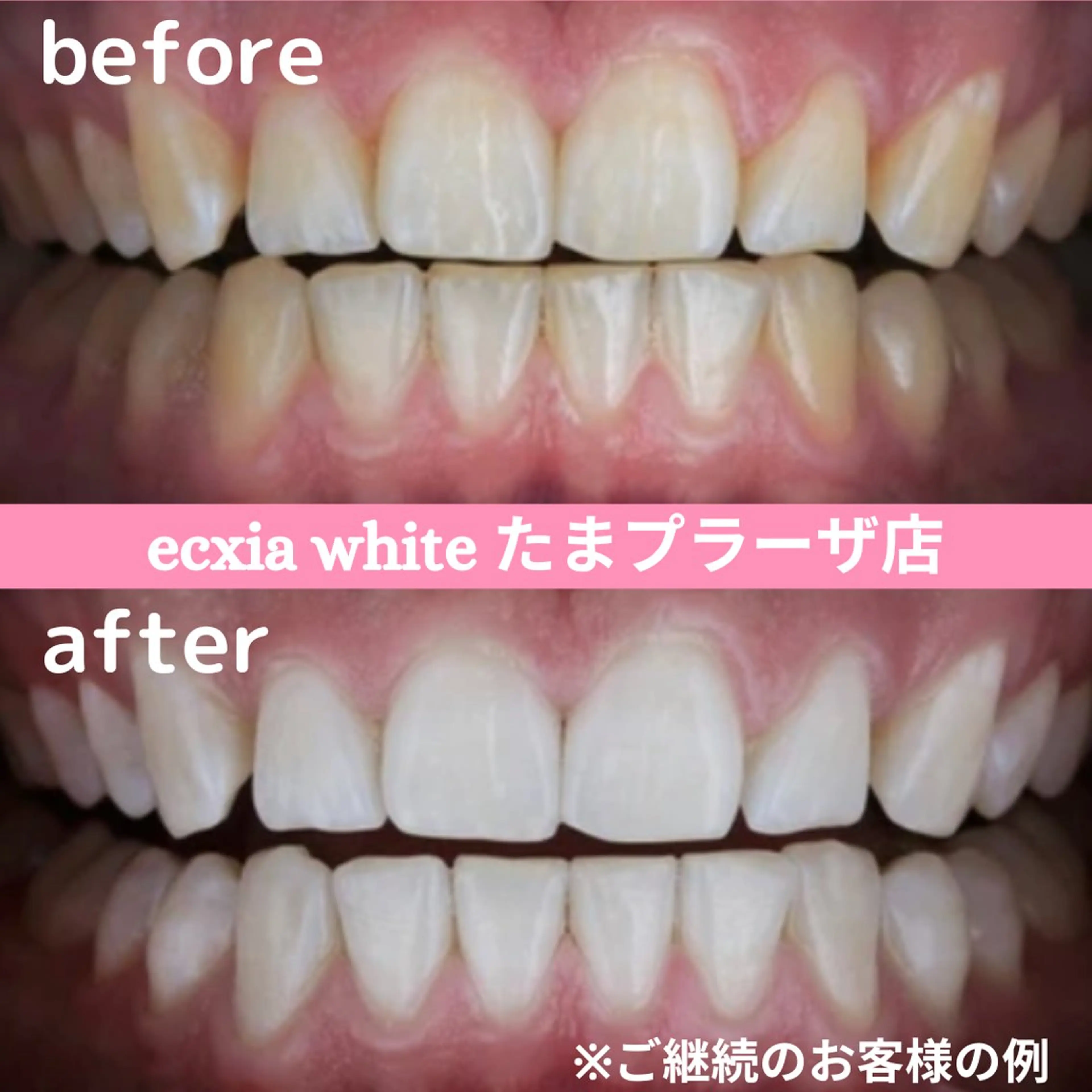 セルフホワイトニング　エクシアたまプラーザ店所属・yukari - オーナー -のその他イメージ