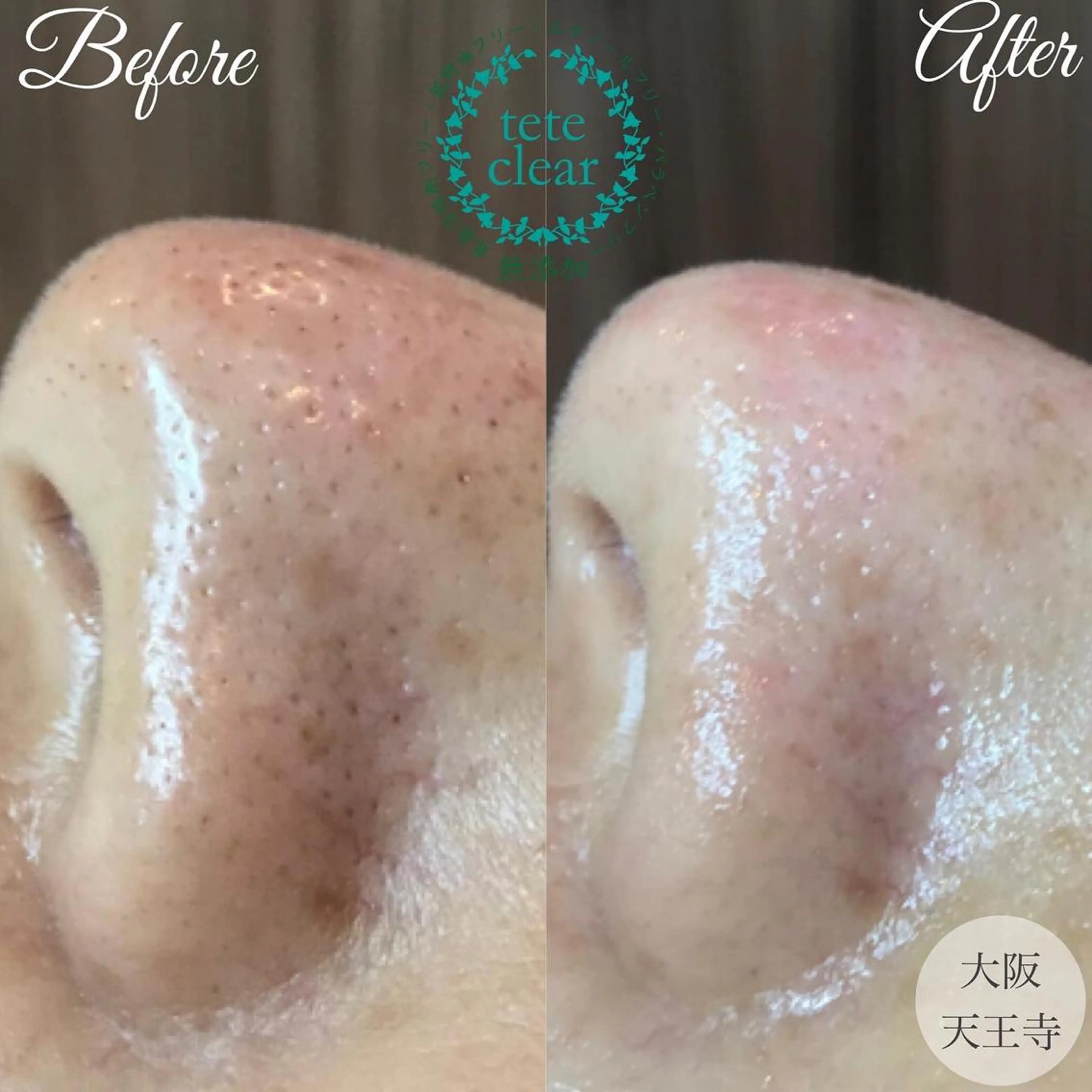 ショート しみ毛穴専門店 Ankh 平田のエステ・リラクイメージ