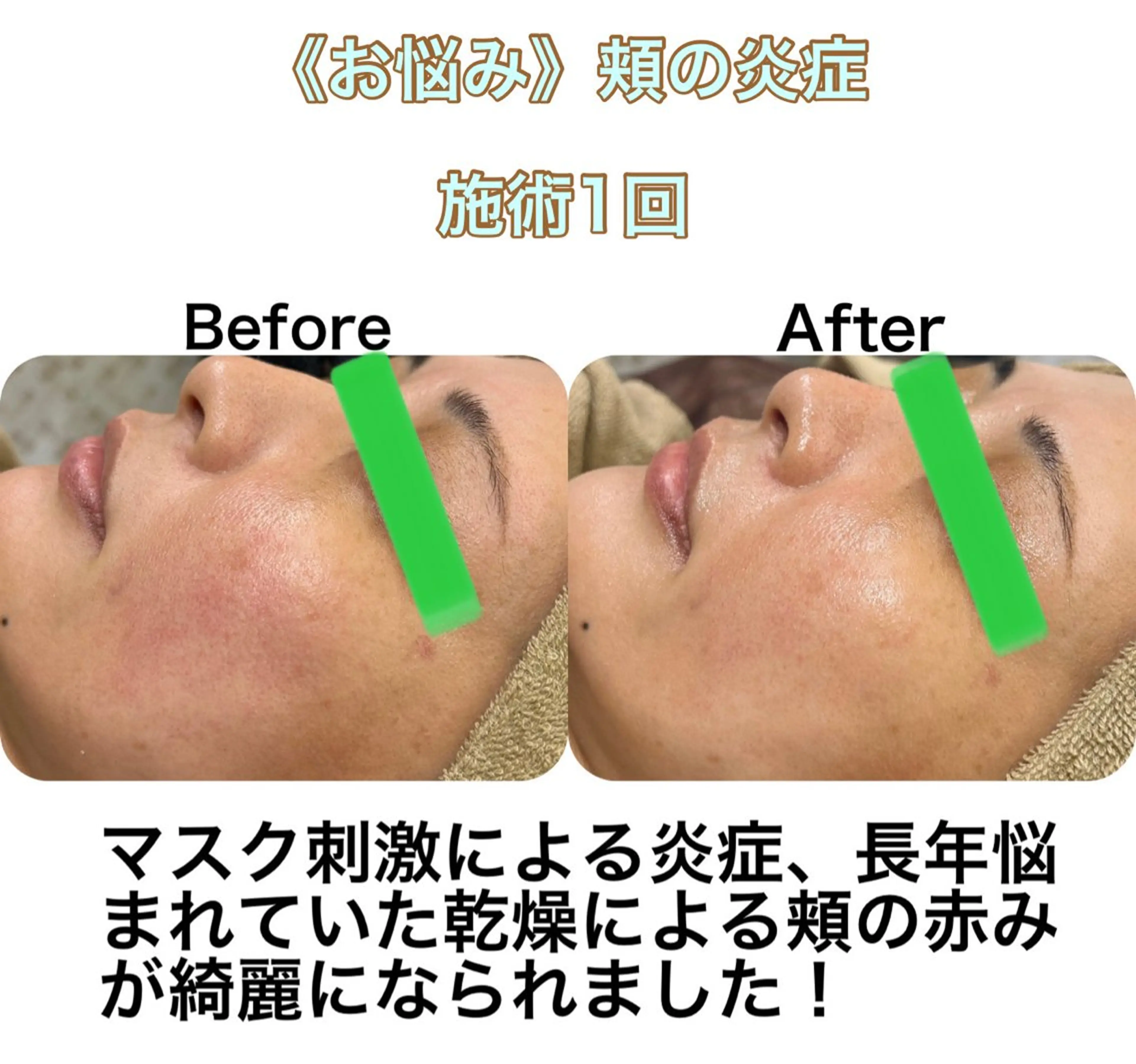 小顔&美肌品川店 Masqueradeのエステ・リラクイメージ