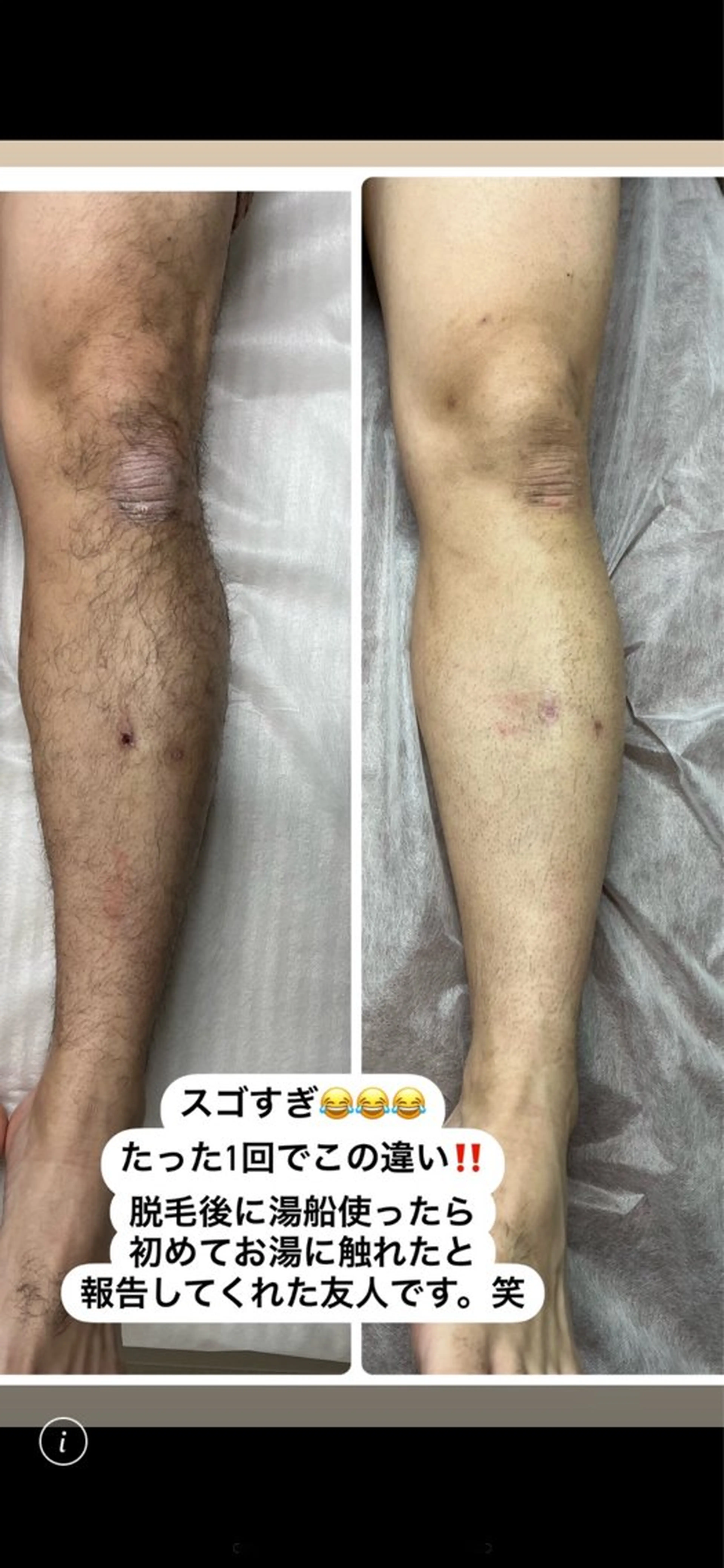 メンズ 肌質改善/都度脱毛 Mahinaのエステ・リラクイメージ