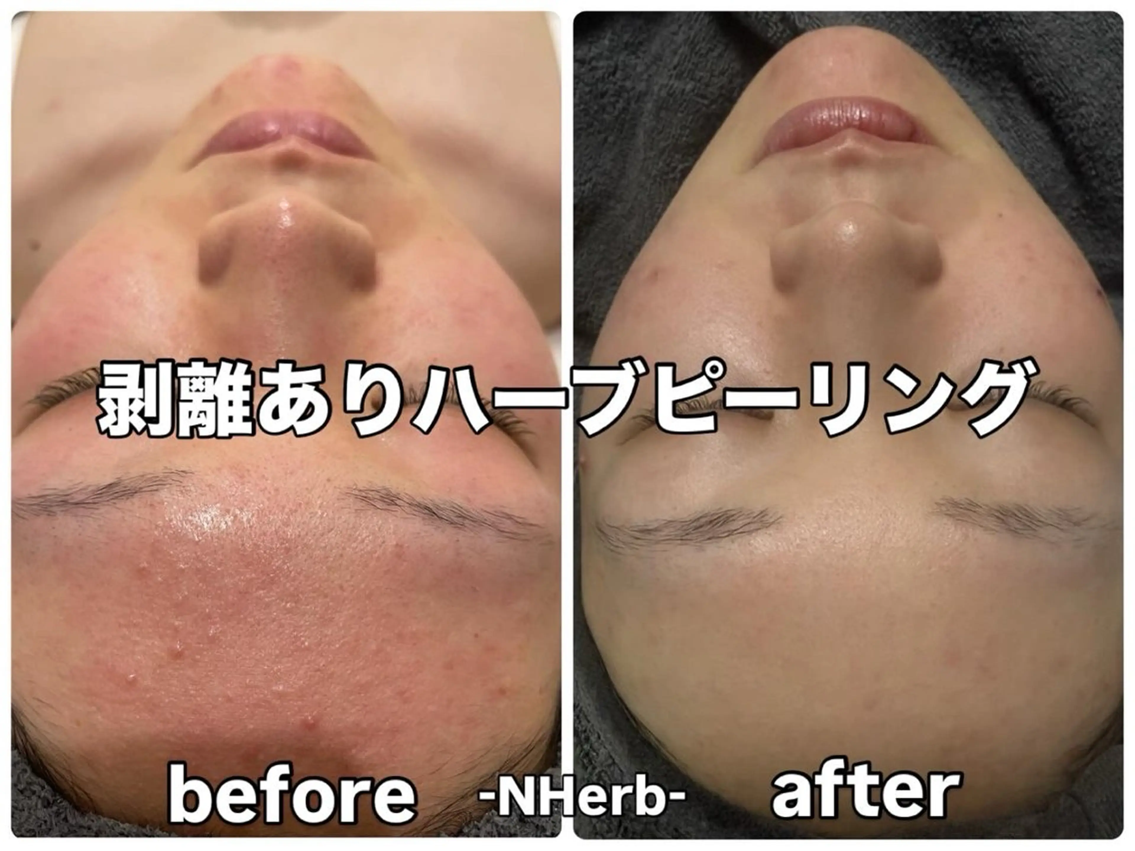 エステ 横田 汐里のネイルデザイン