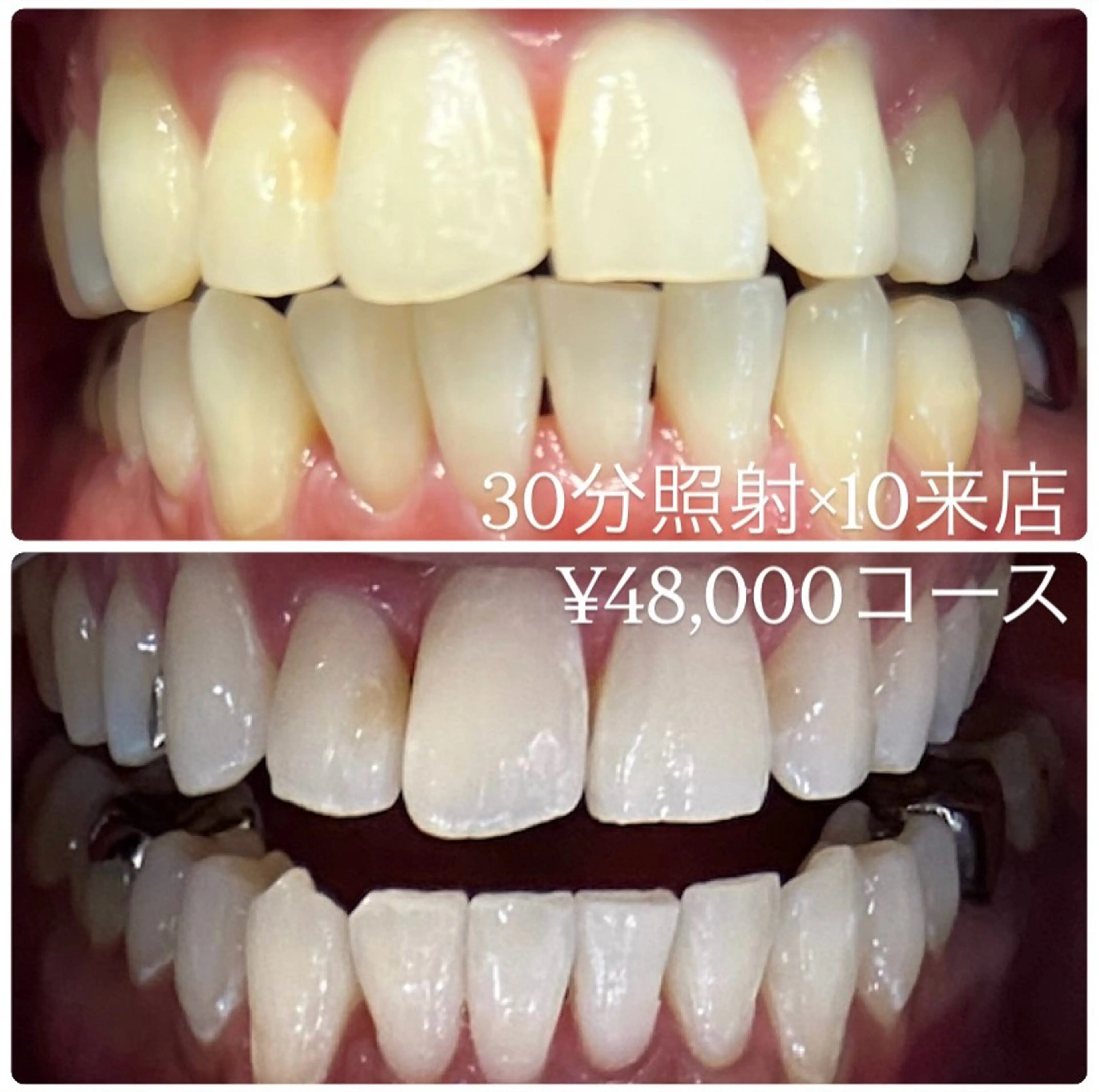 ホワイトニングルーム 横浜店のその他イメージ