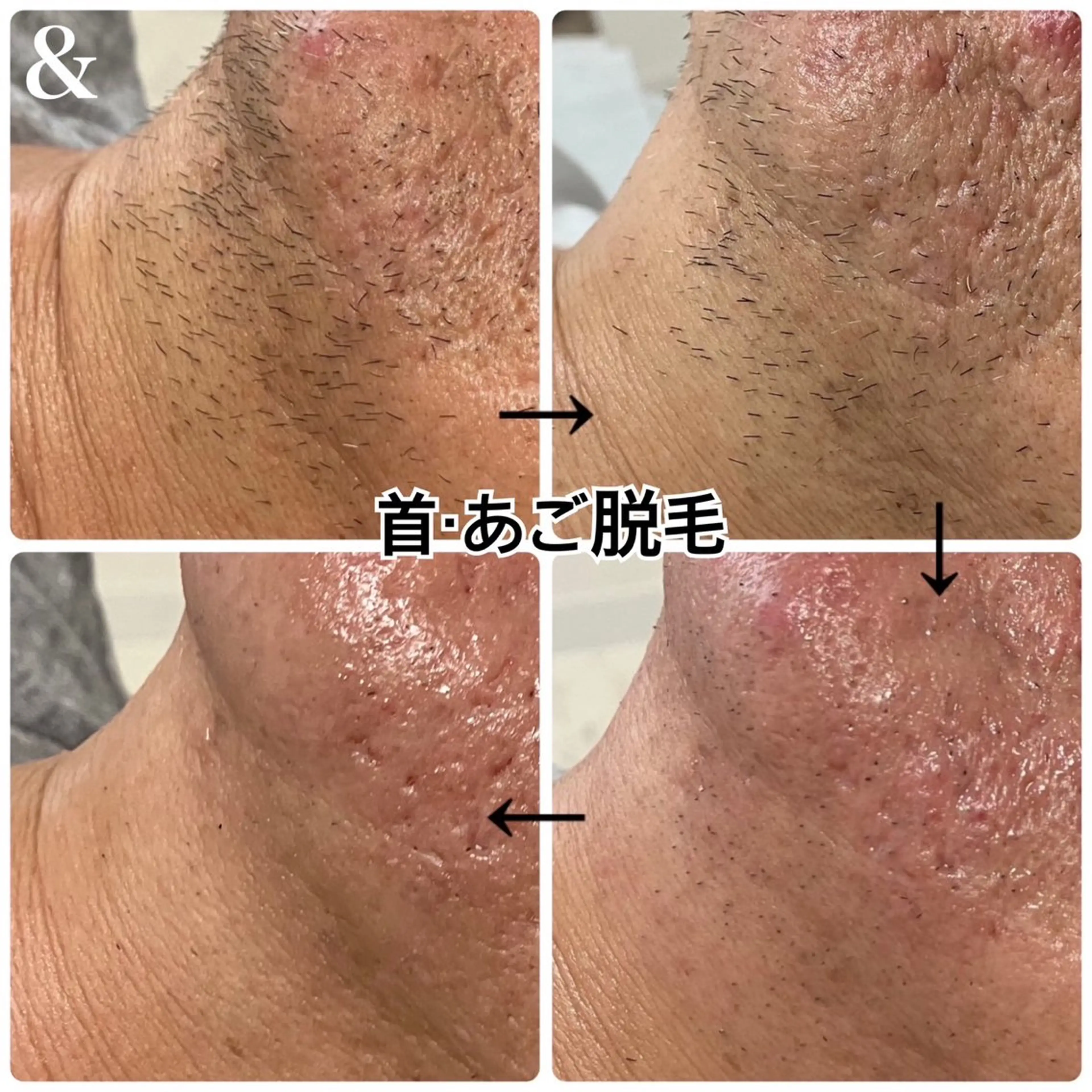 メンズ nail salon 【Rire】のネイルデザイン