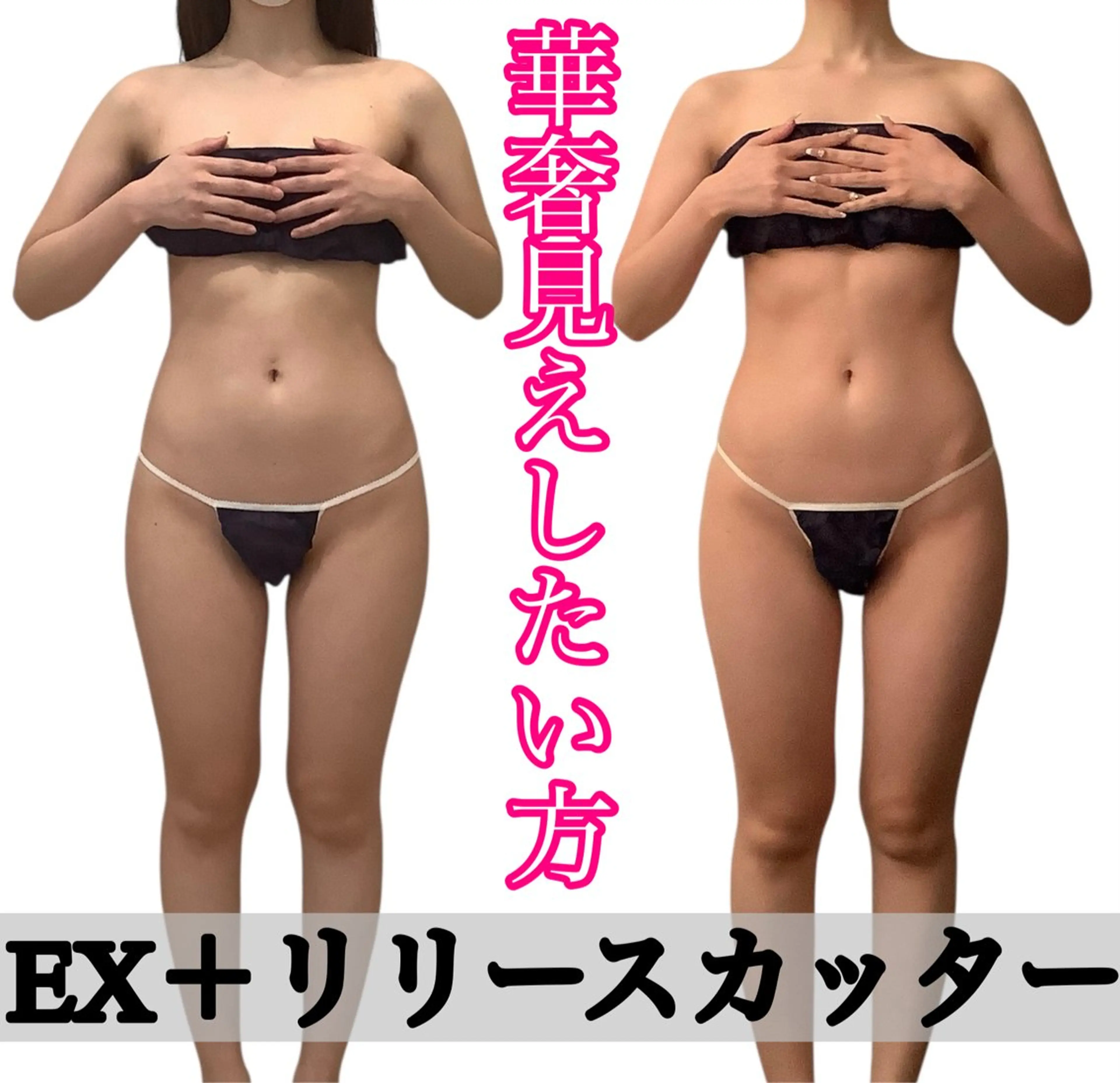 痩身ダイエット&小顔専門店Rs slim（アールズスリム）所属・痩身ダイエット&小顔 🩷アールズスリムのエステ・リラクイメージ
