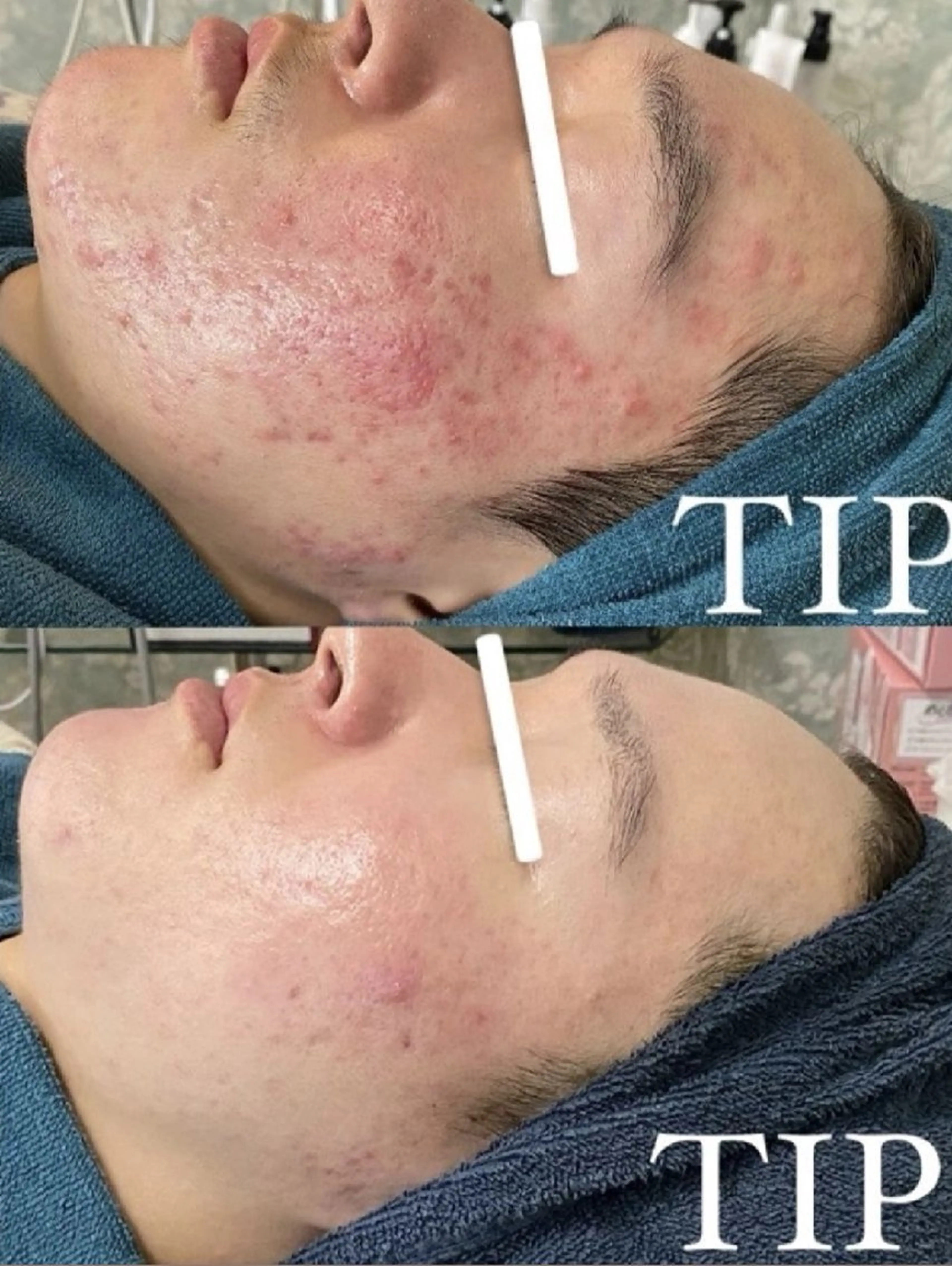 エステ Ellebeauty relaxationのエステ・リラクイメージ