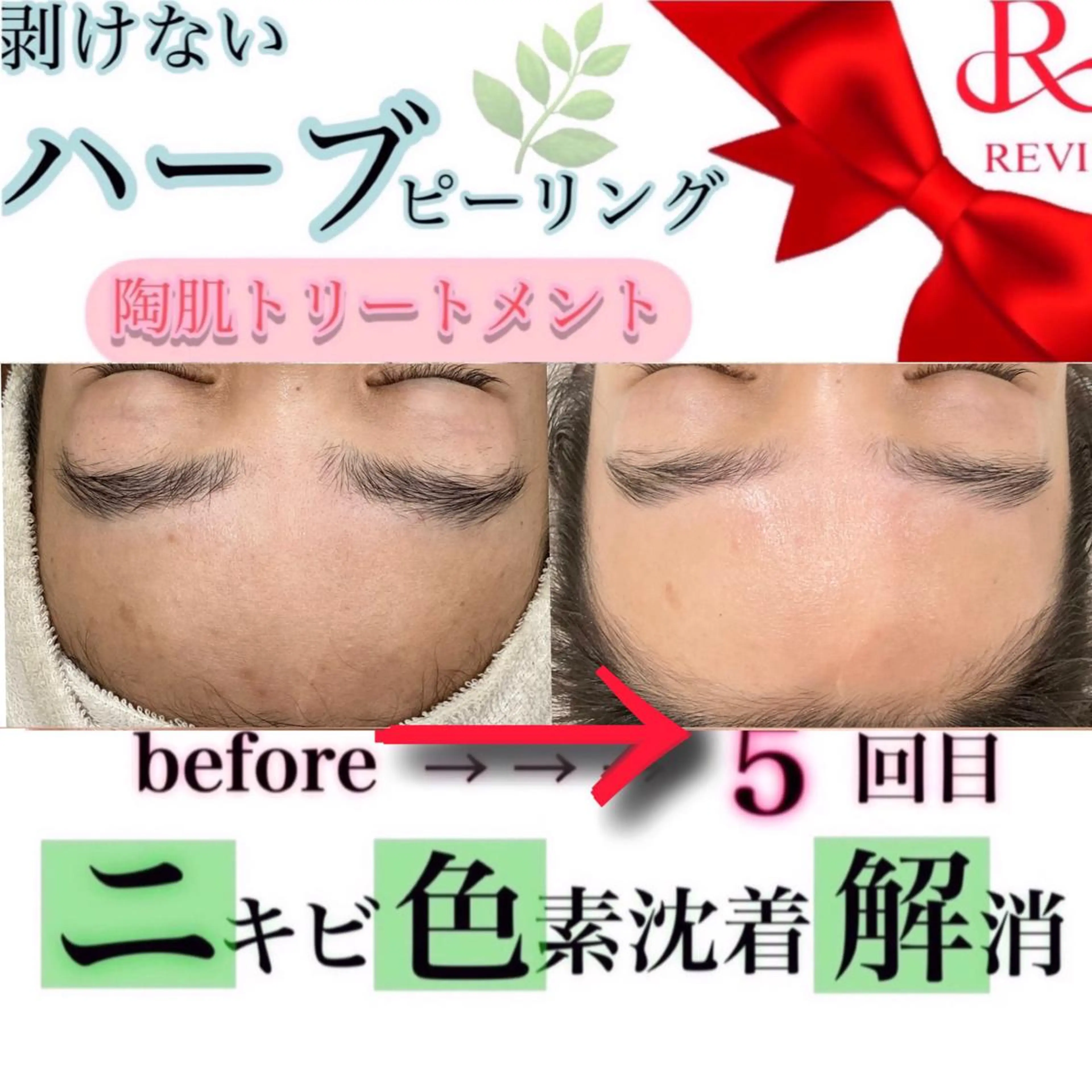 laluna saki...のその他イメージ