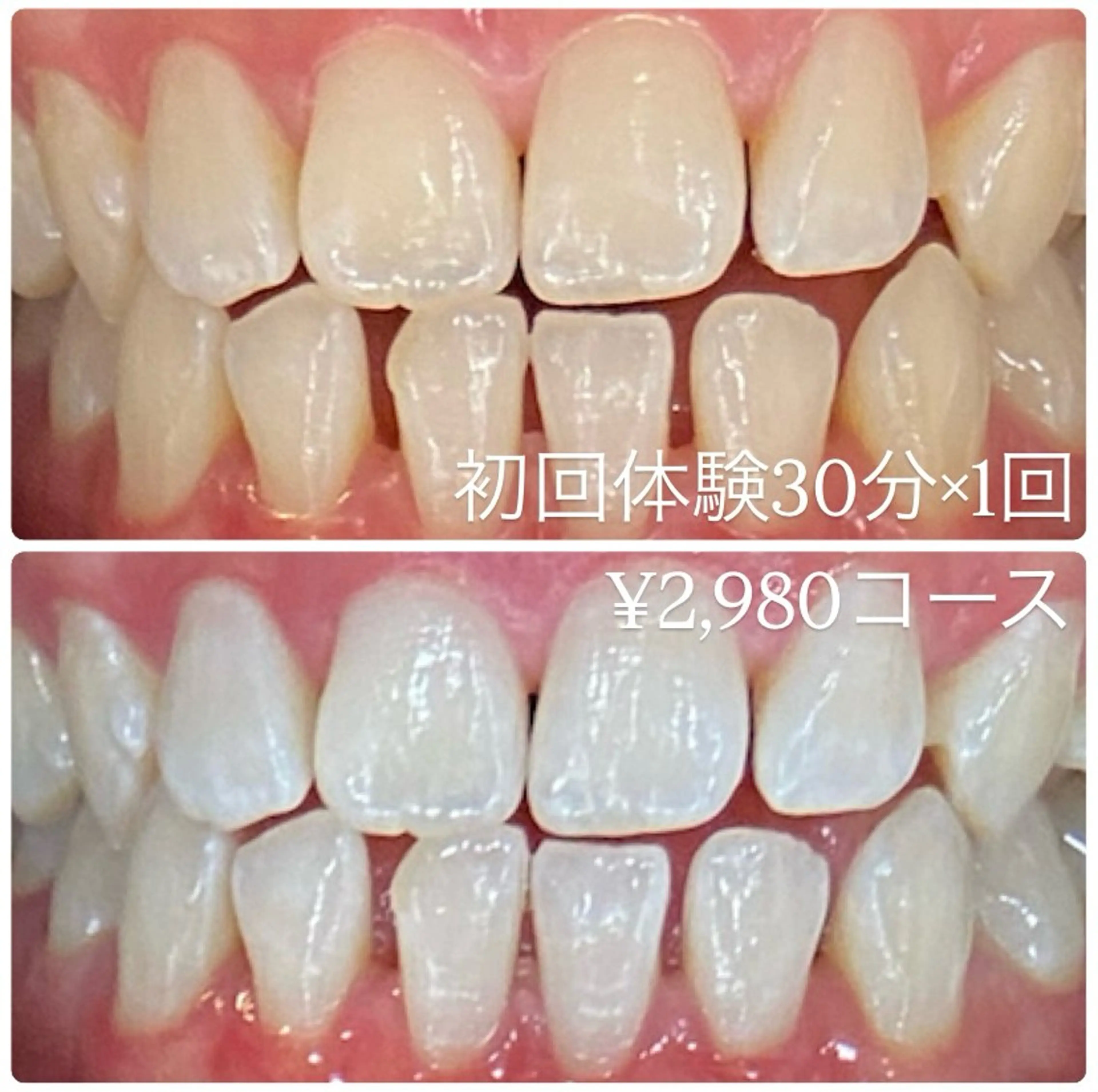 ホワイトニングルーム 横浜店のその他イメージ