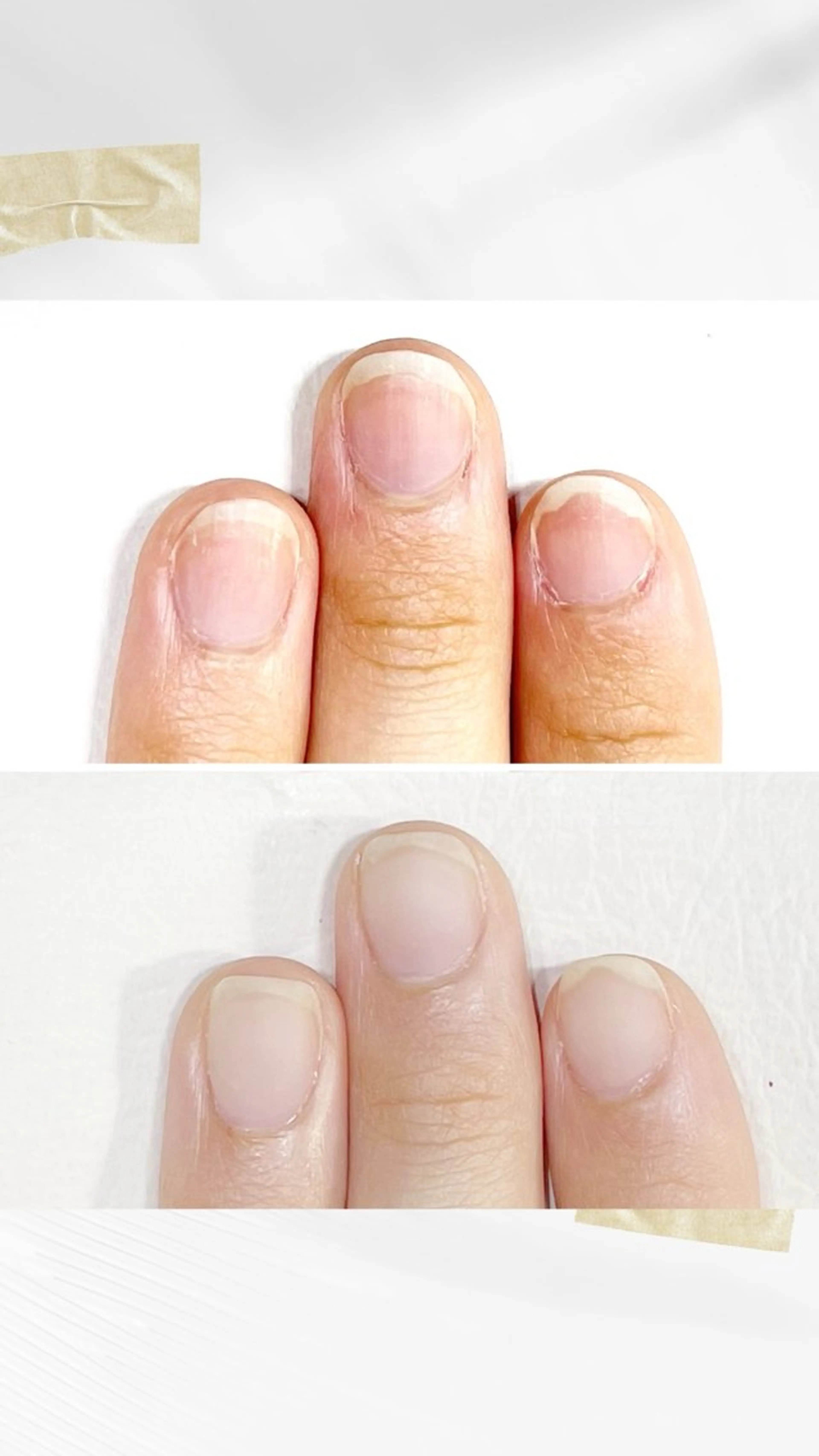 ネイル 深爪・巻き爪 専門サンセリテのネイルデザイン