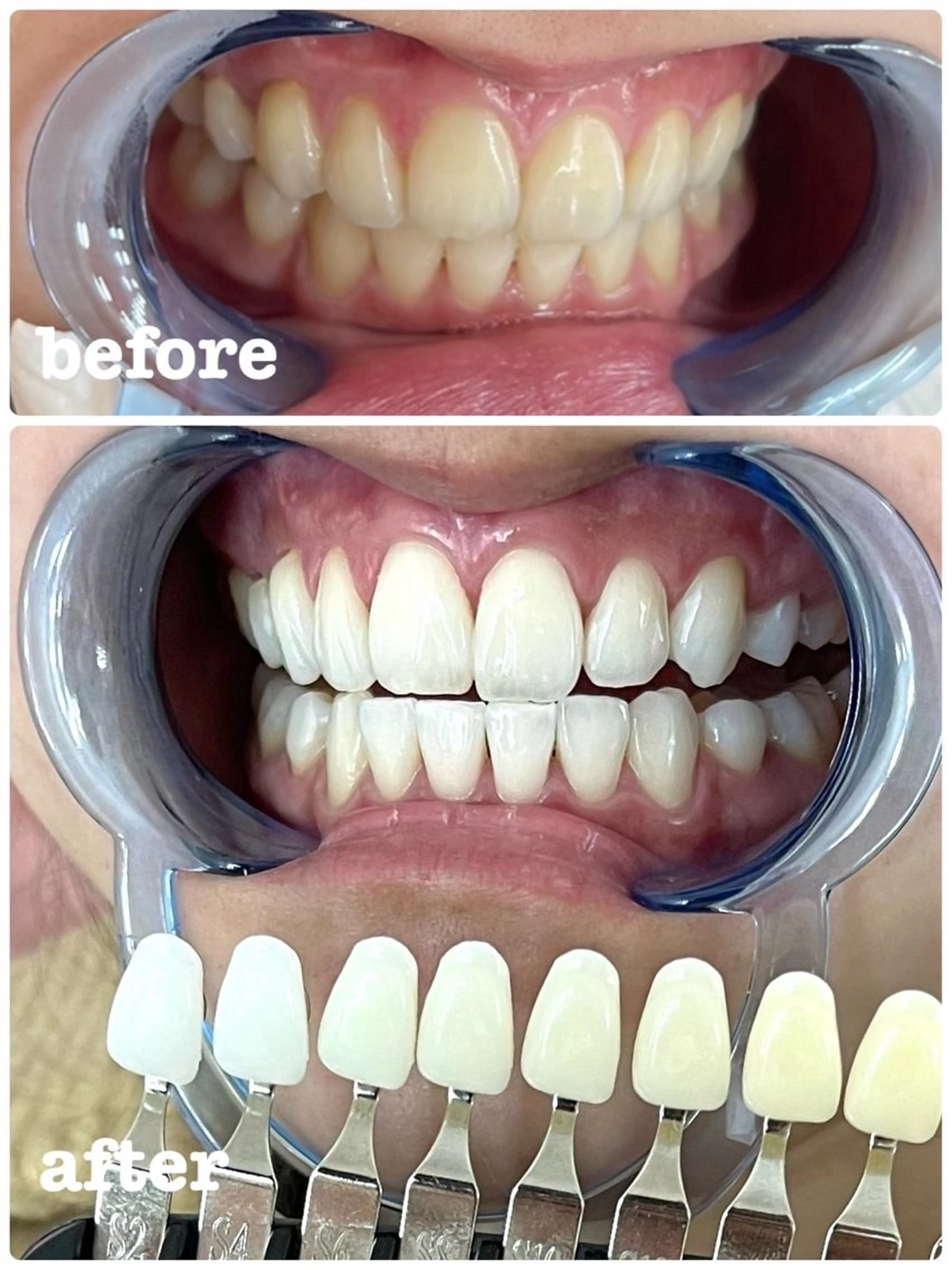 セルフホワイトニング エクシア徳島店マユのその他イメージ