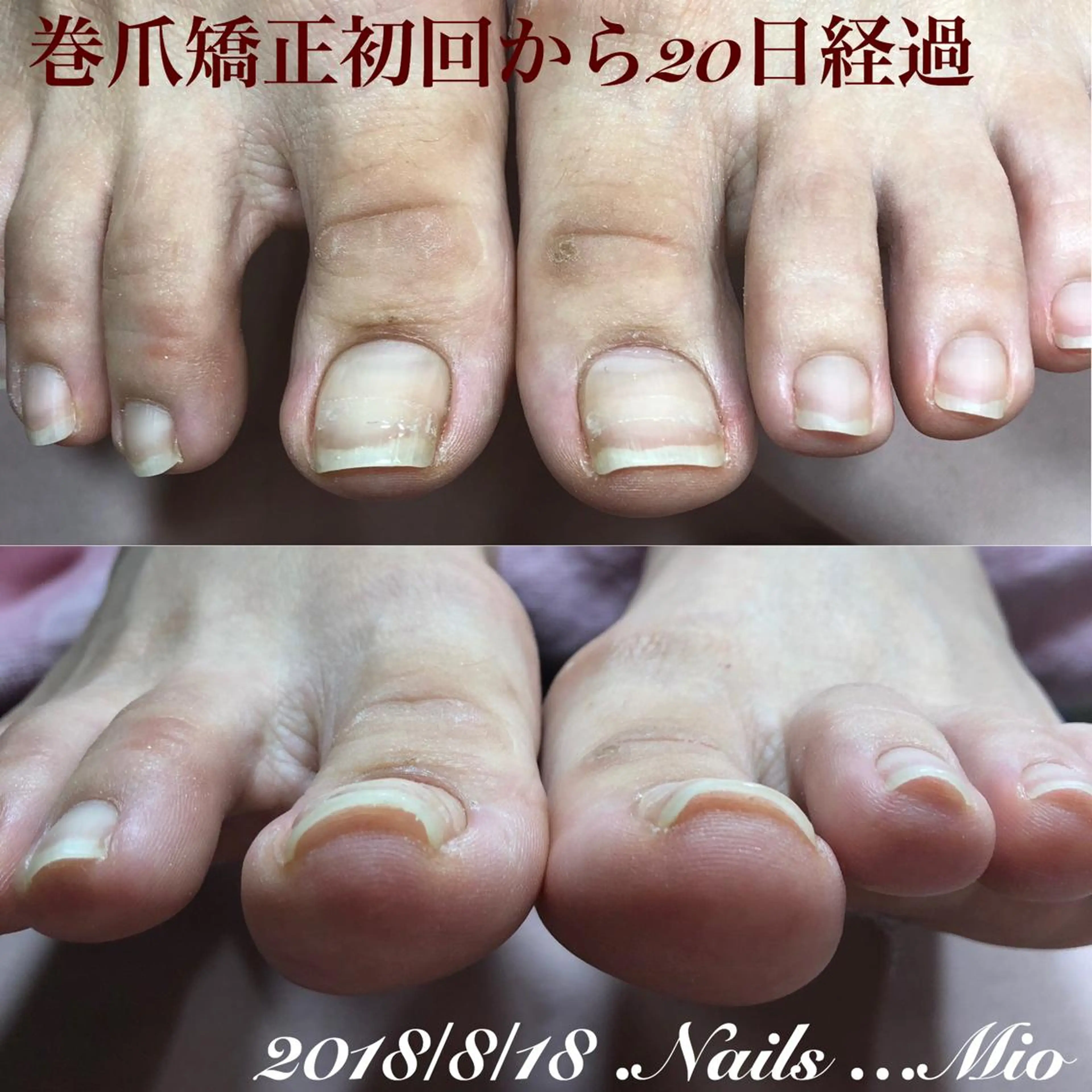 ネイル .Nails Mio 赤羽西ネイルサロンのネイルデザイン