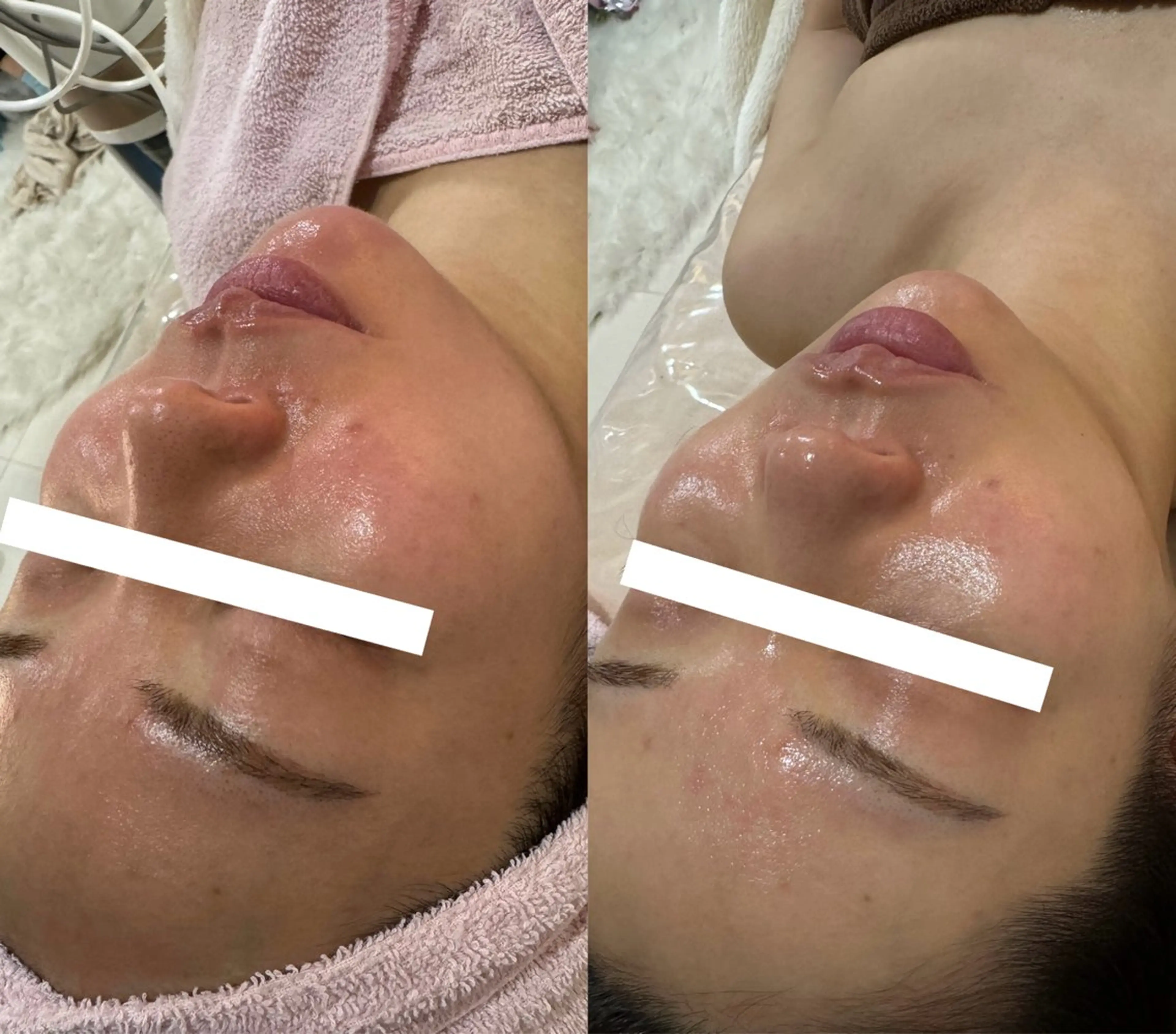 salondeBe 🩵フェイシャル専門のエステ・リラクイメージ