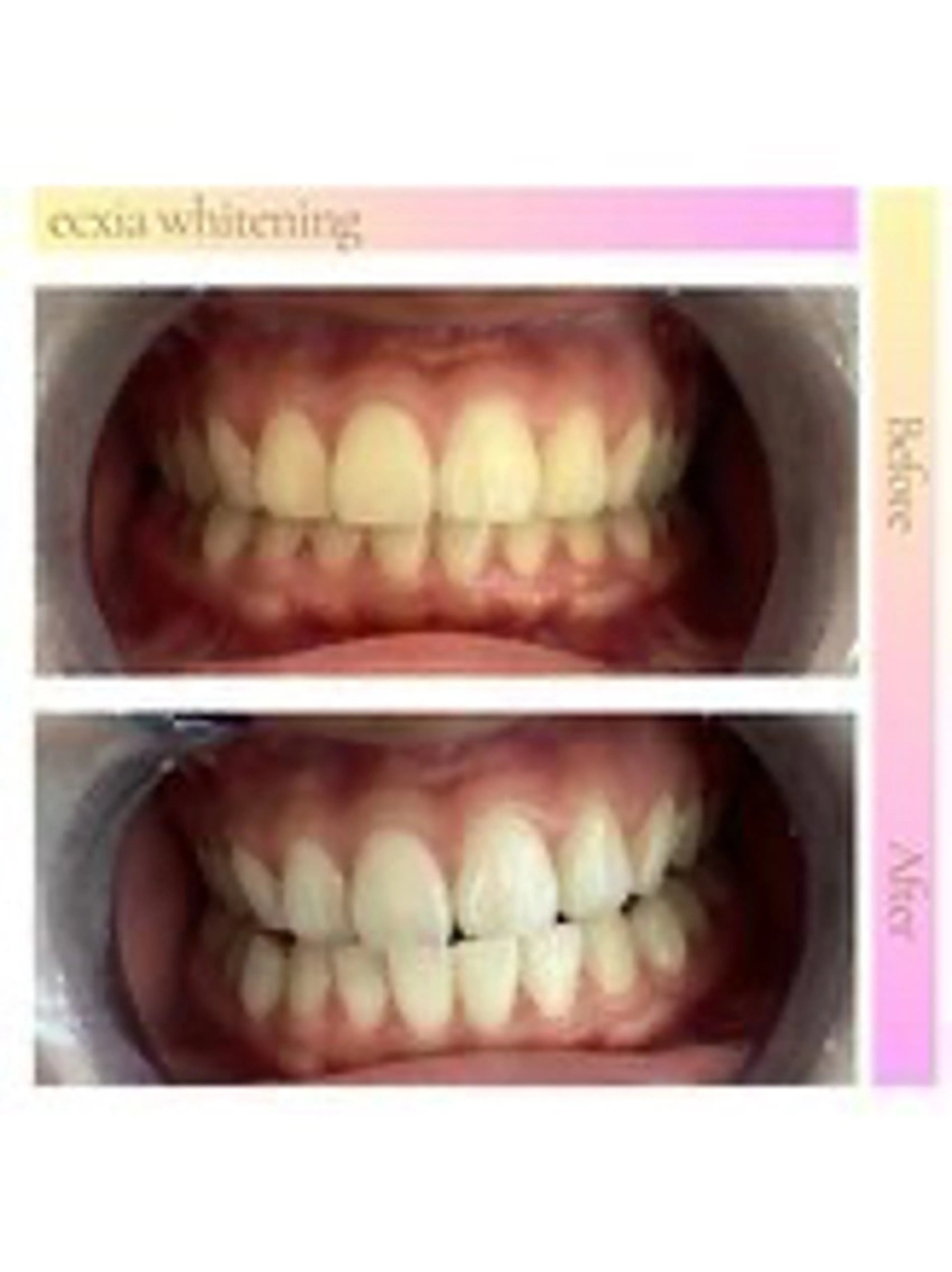 セルフホワイトニング エクシア西宮北口店所属・セルフホワイトニング エクシア西宮北口店のその他イメージ