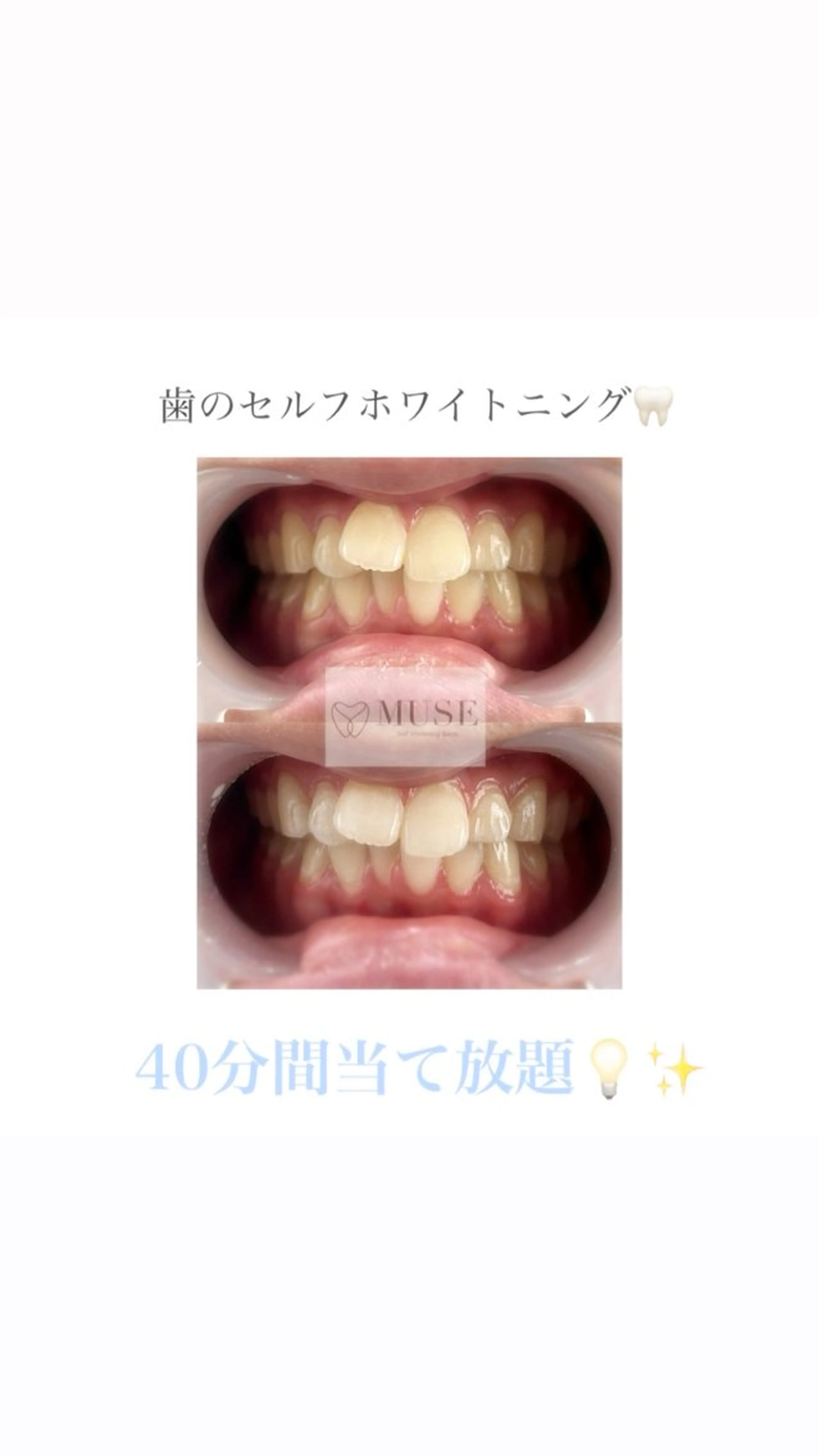 その他 セルフホワイトニング MUSE🫧焼津のその他イメージ