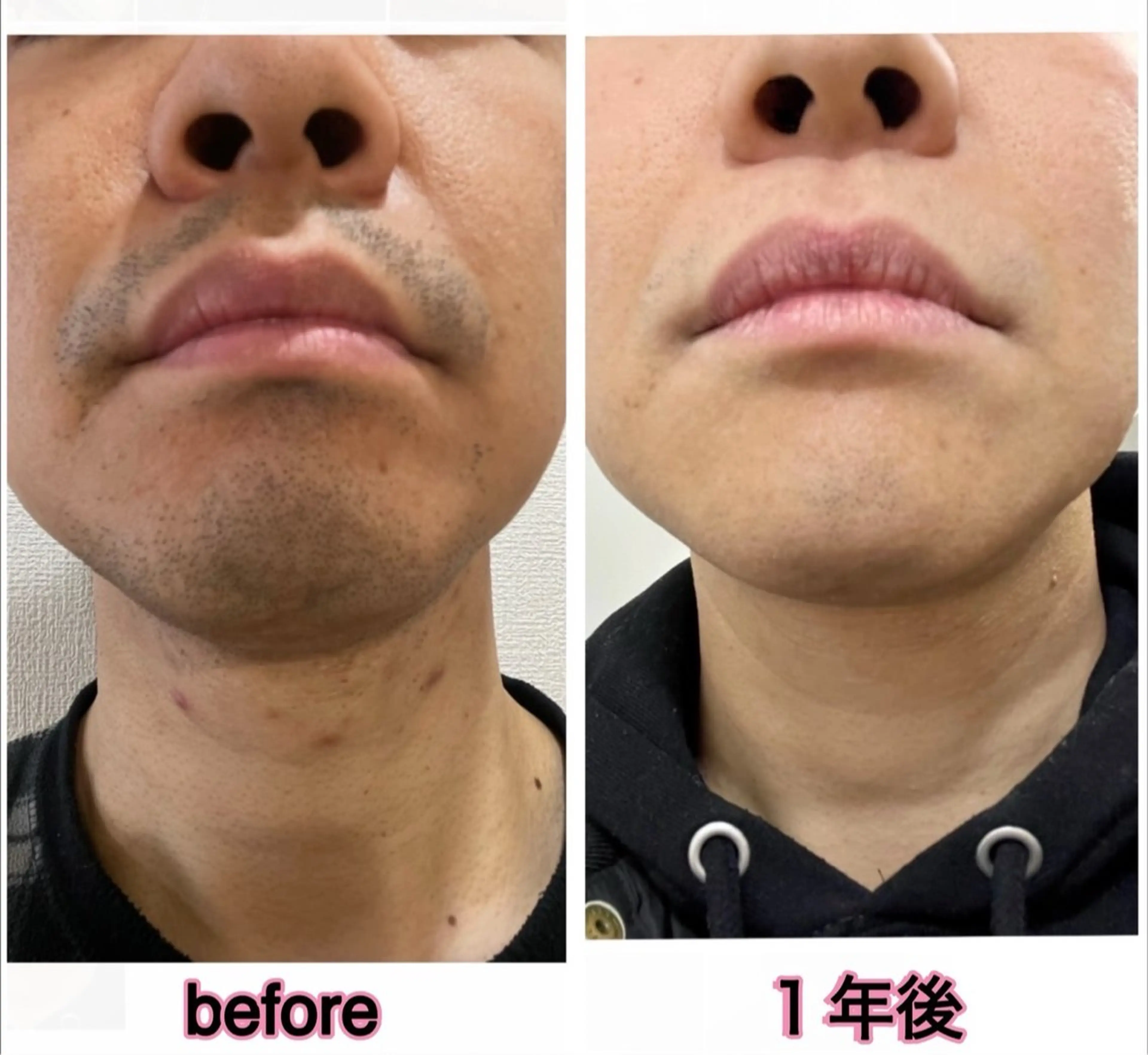 LastResort 荒尾のエステ・リラクイメージ