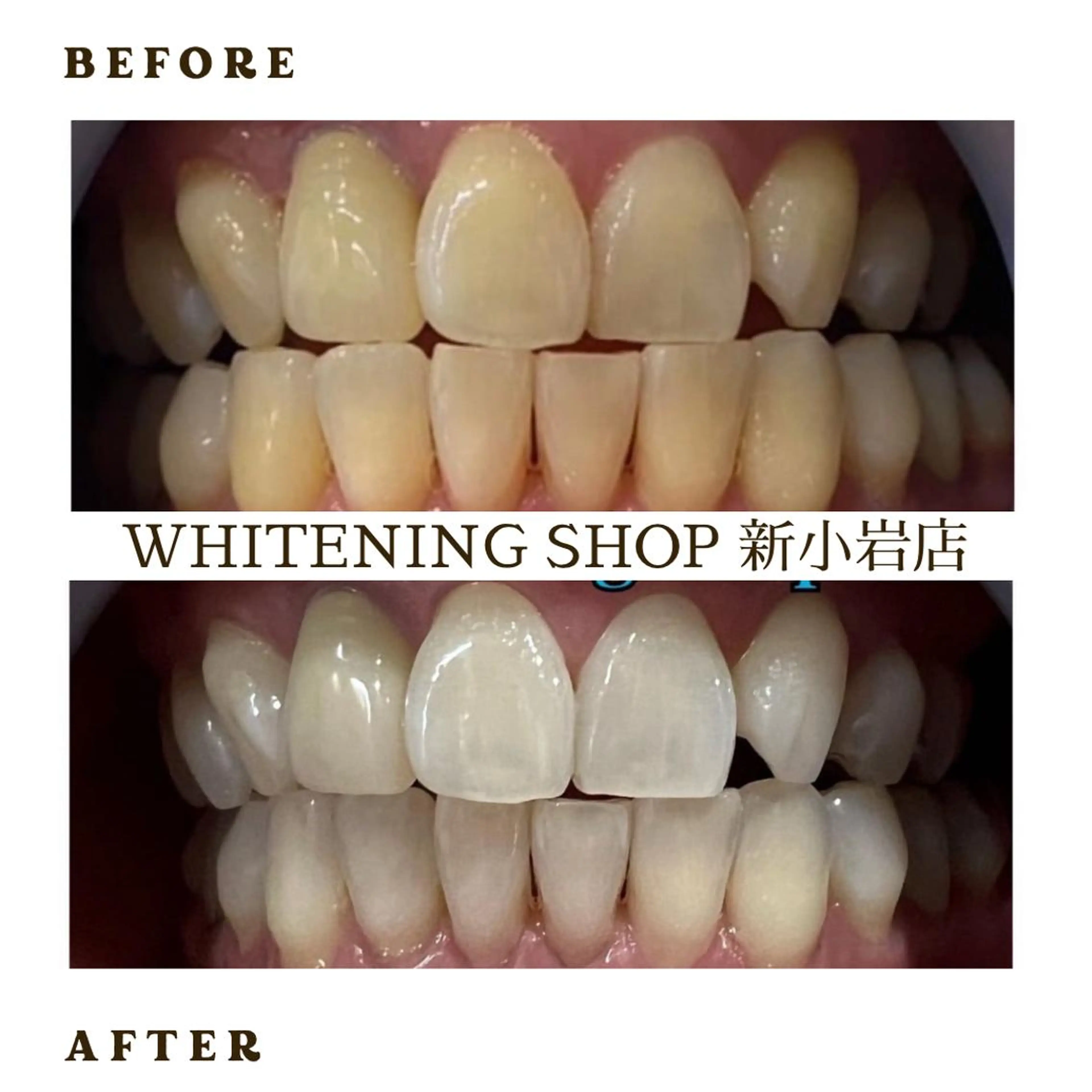 メンズ ホワイトニング ショップ新小岩店のその他イメージ