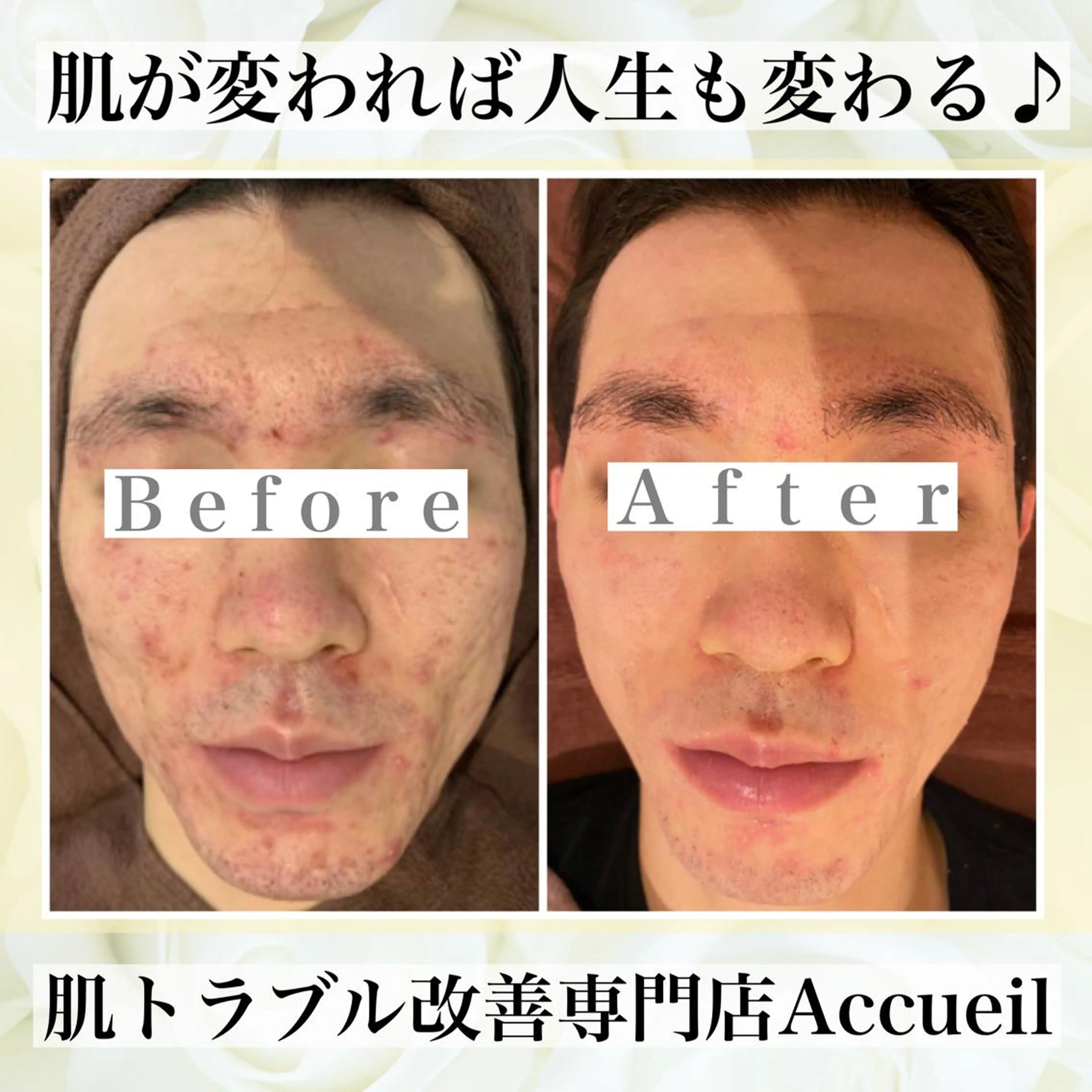 ミディアム カラー パーマ ヘアアレンジ メンズ キッズ ネイル マツエク・マツパ エステ リラク ニキビ・肌質改善専門 ♡人生が変わるサロンのエステ・リラクイメージ