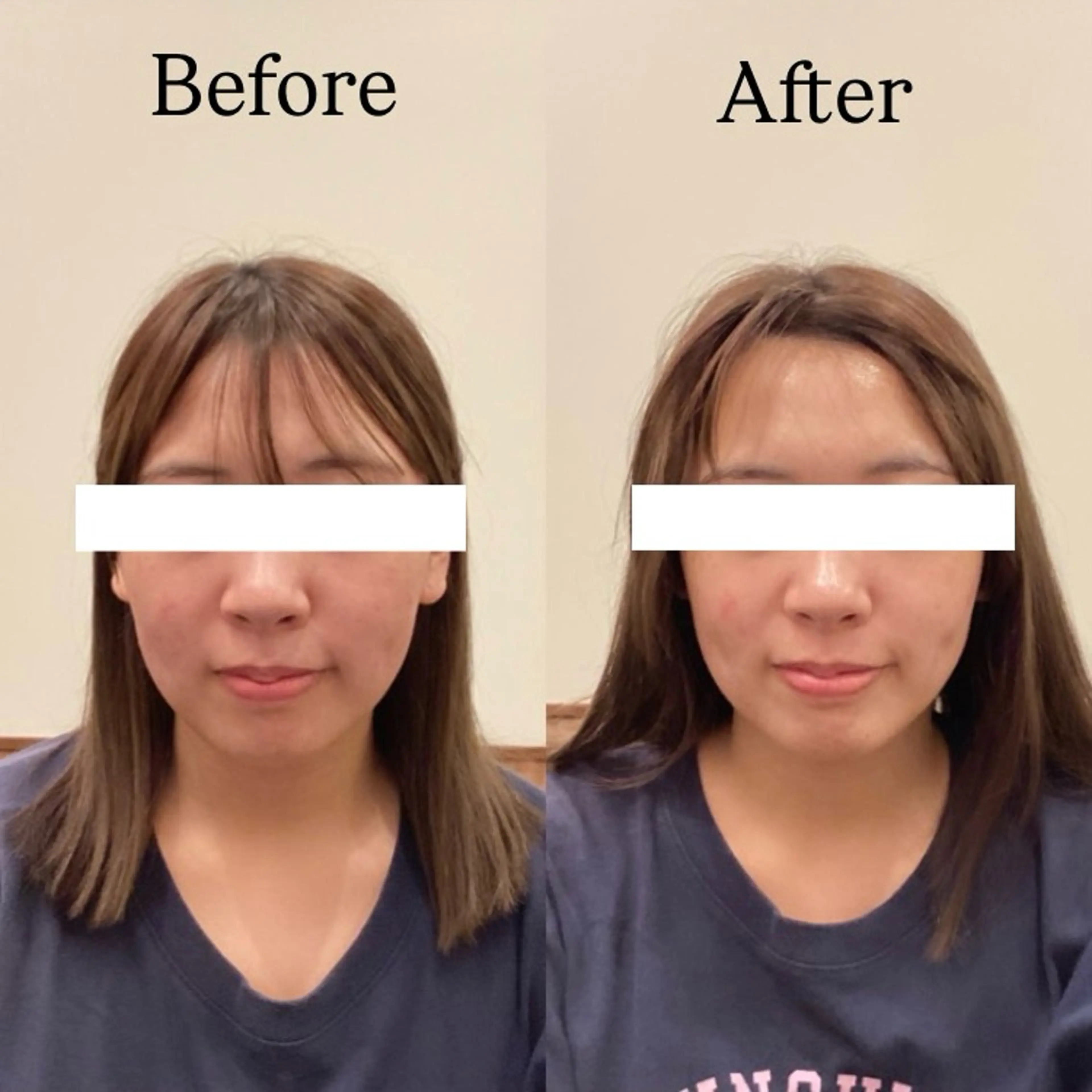 chika🦋 ハリラウンジ恵比寿のエステ・リラクイメージ