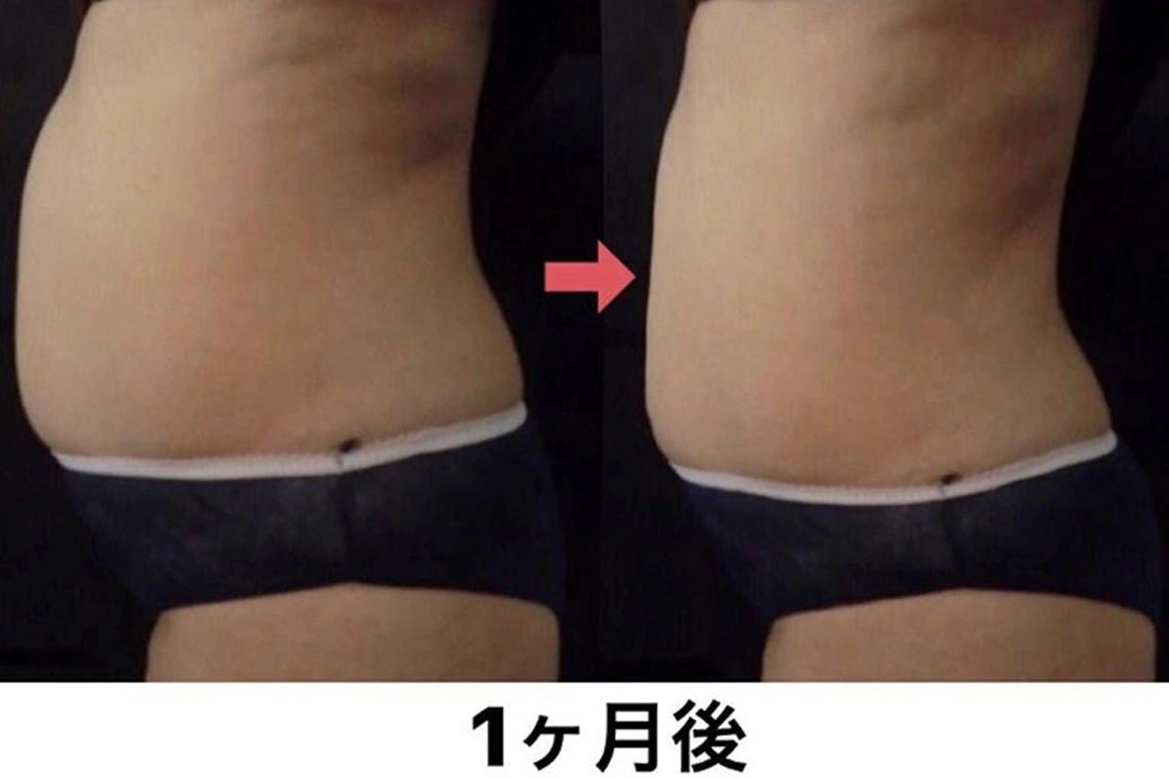 横浜エステサロン R-ing　リングのエステ・リラクイメージ