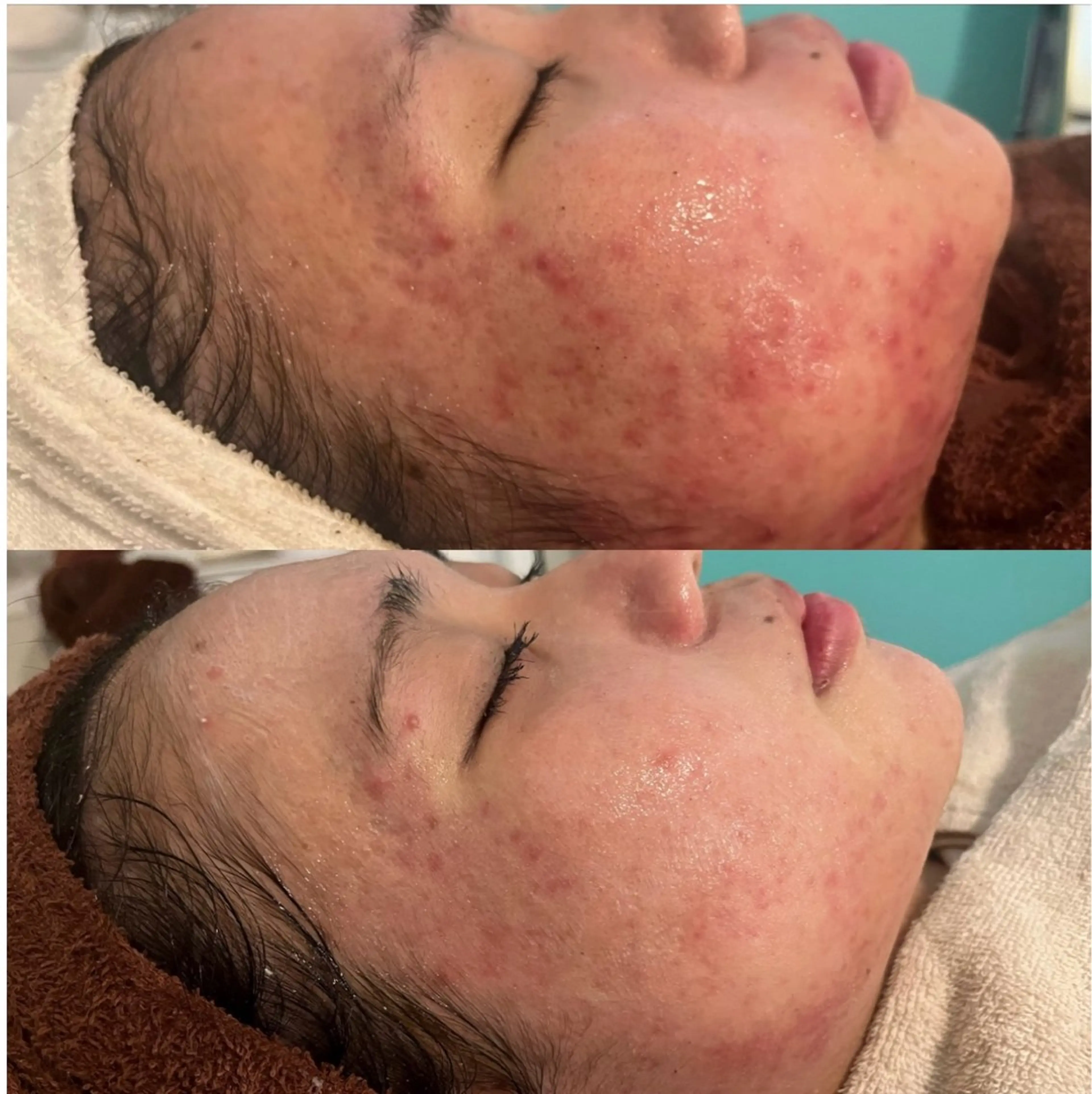 エステ リラク 韓国肌管理Belle 後楽園のエステ・リラクイメージ