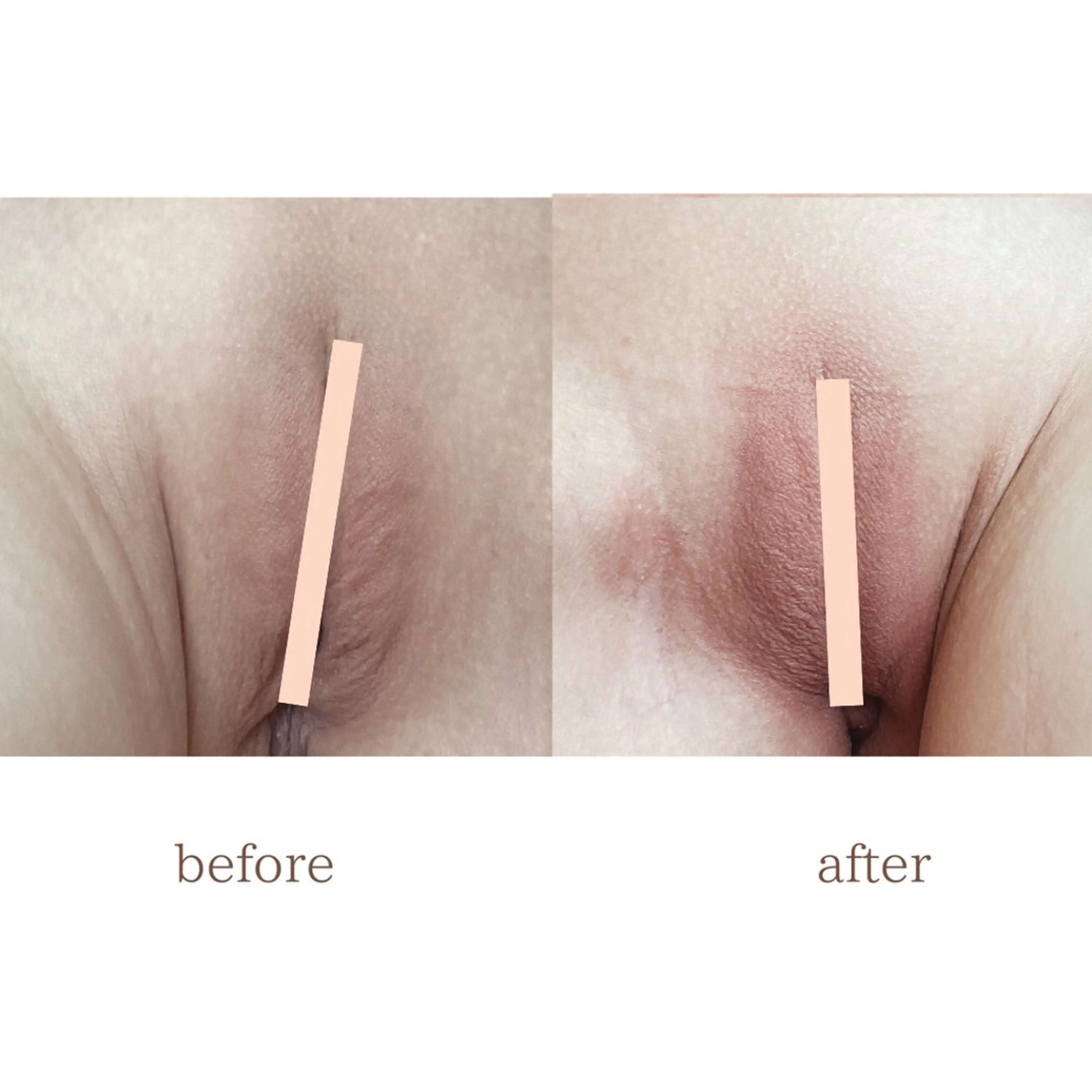 小顔/たるみ/黒ずみ除去専門サロン/SONA 大和西大寺店所属・【小顔痩身専門看護師 サロンSONA】のエステ・リラクイメージ