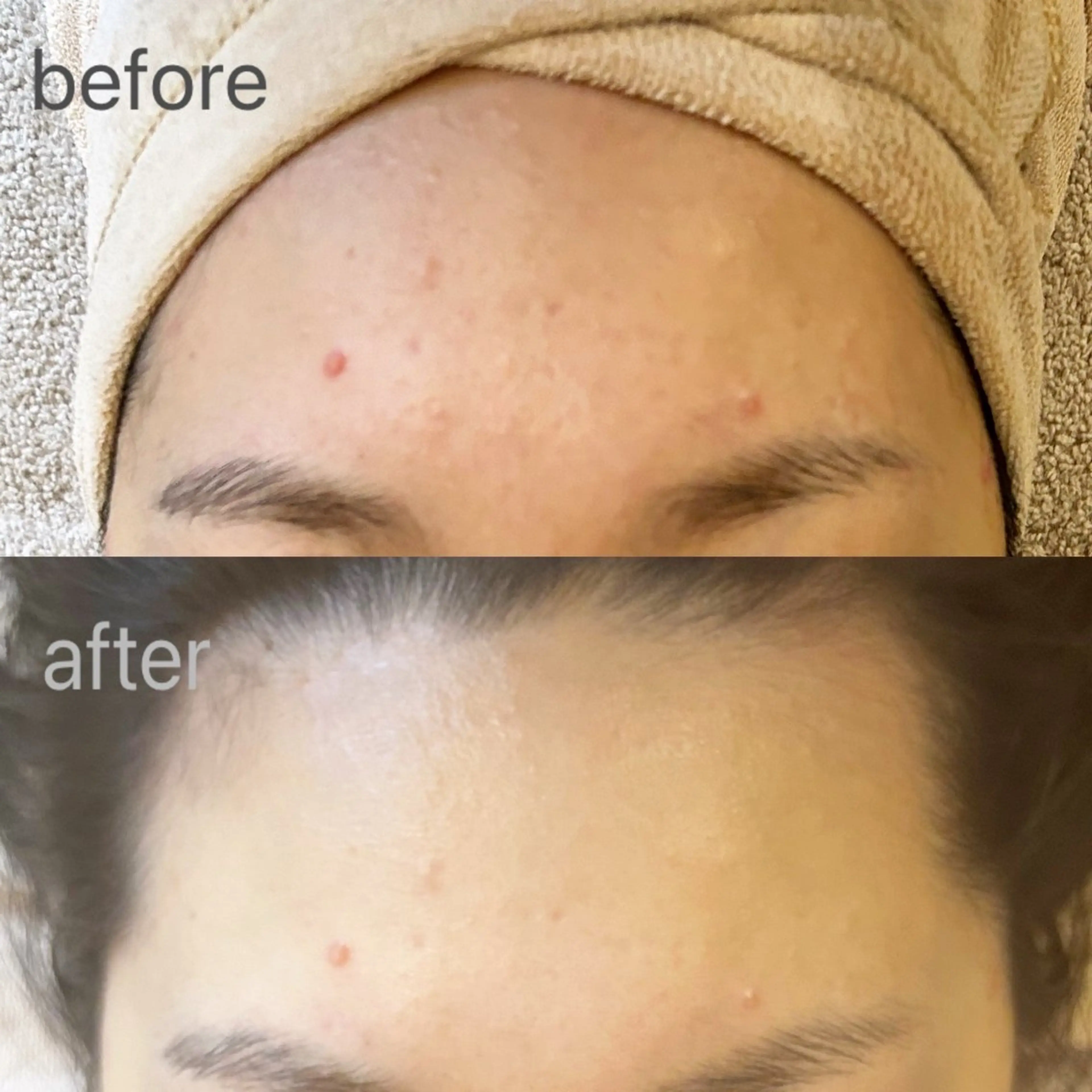 エステ Rie ×MiELのエステ・リラクイメージ