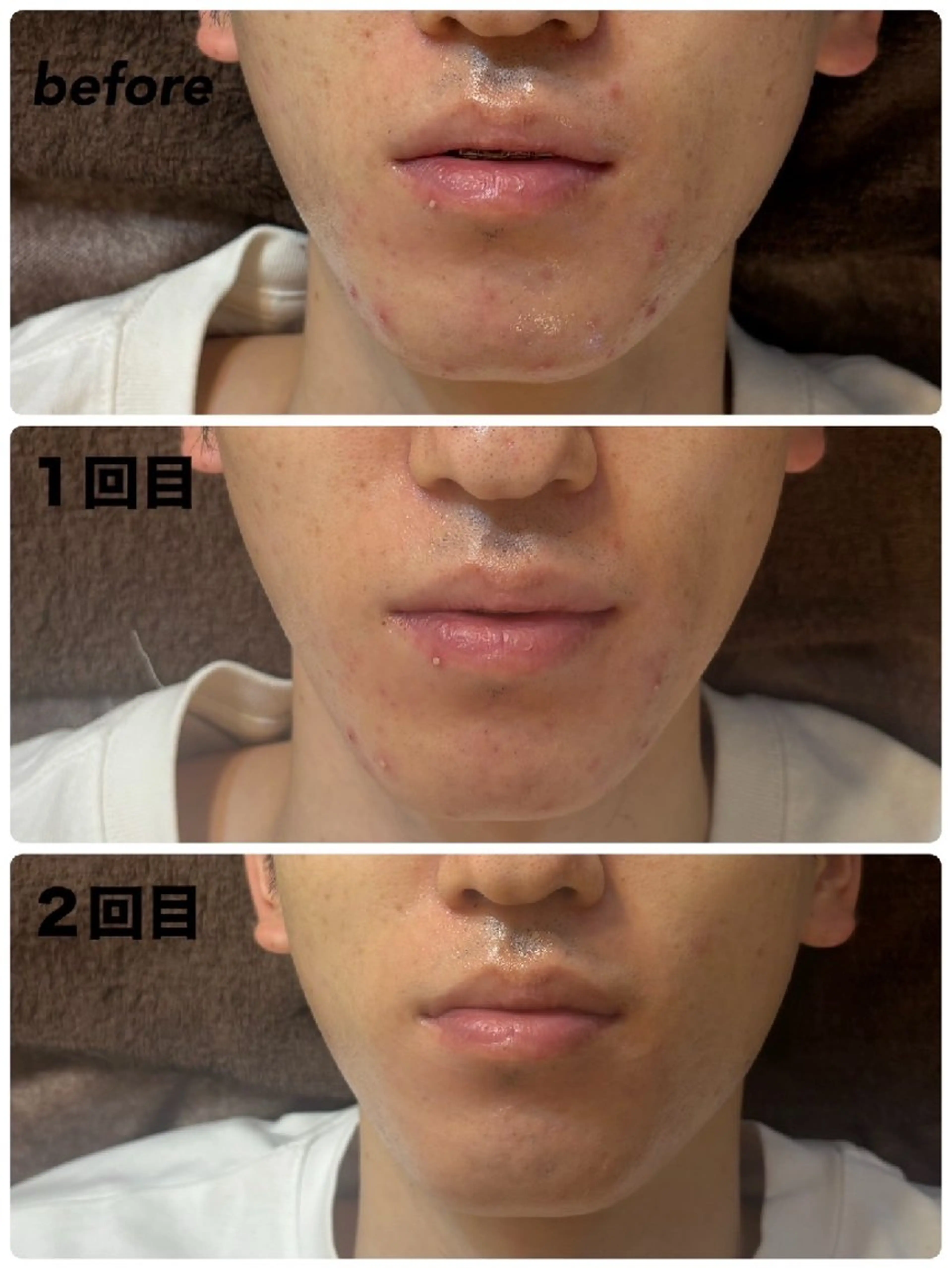 メンズ プライベートサロン✢ Eclatエクラ　のエステ・リラクイメージ