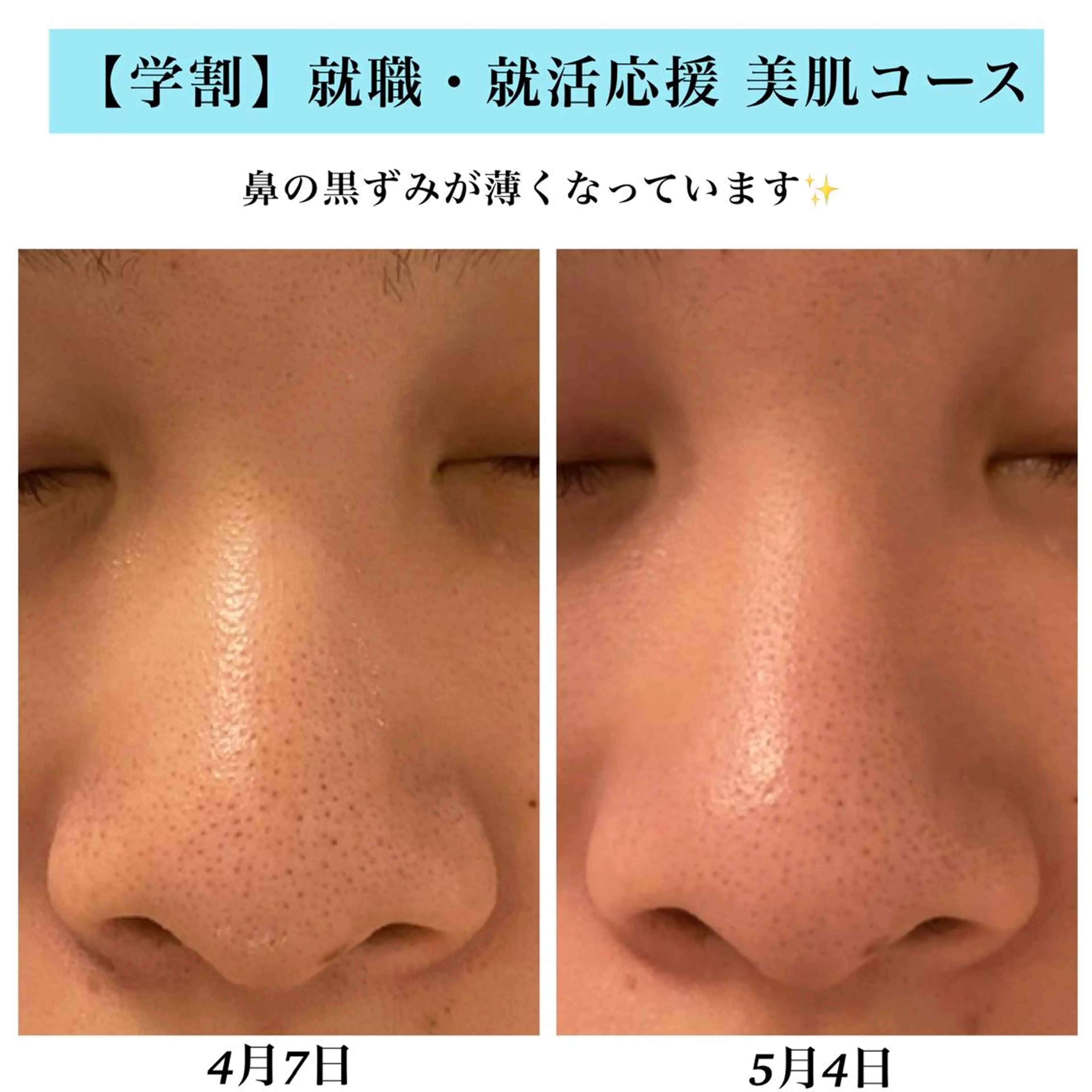 エステ Bellesthe (ベルエステ)のエステ・リラクイメージ