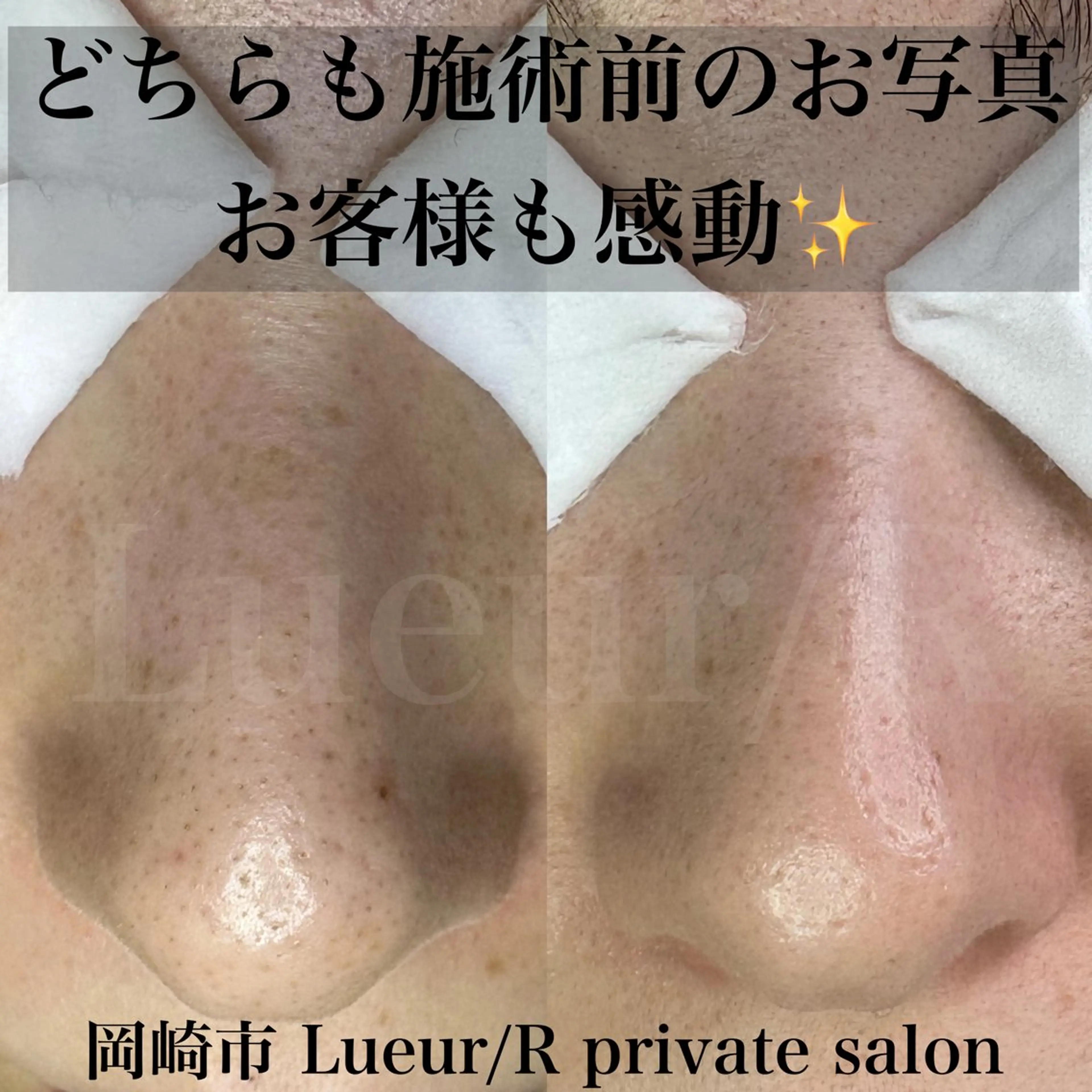 エステ 大久保 里奈のエステ・リラクイメージ