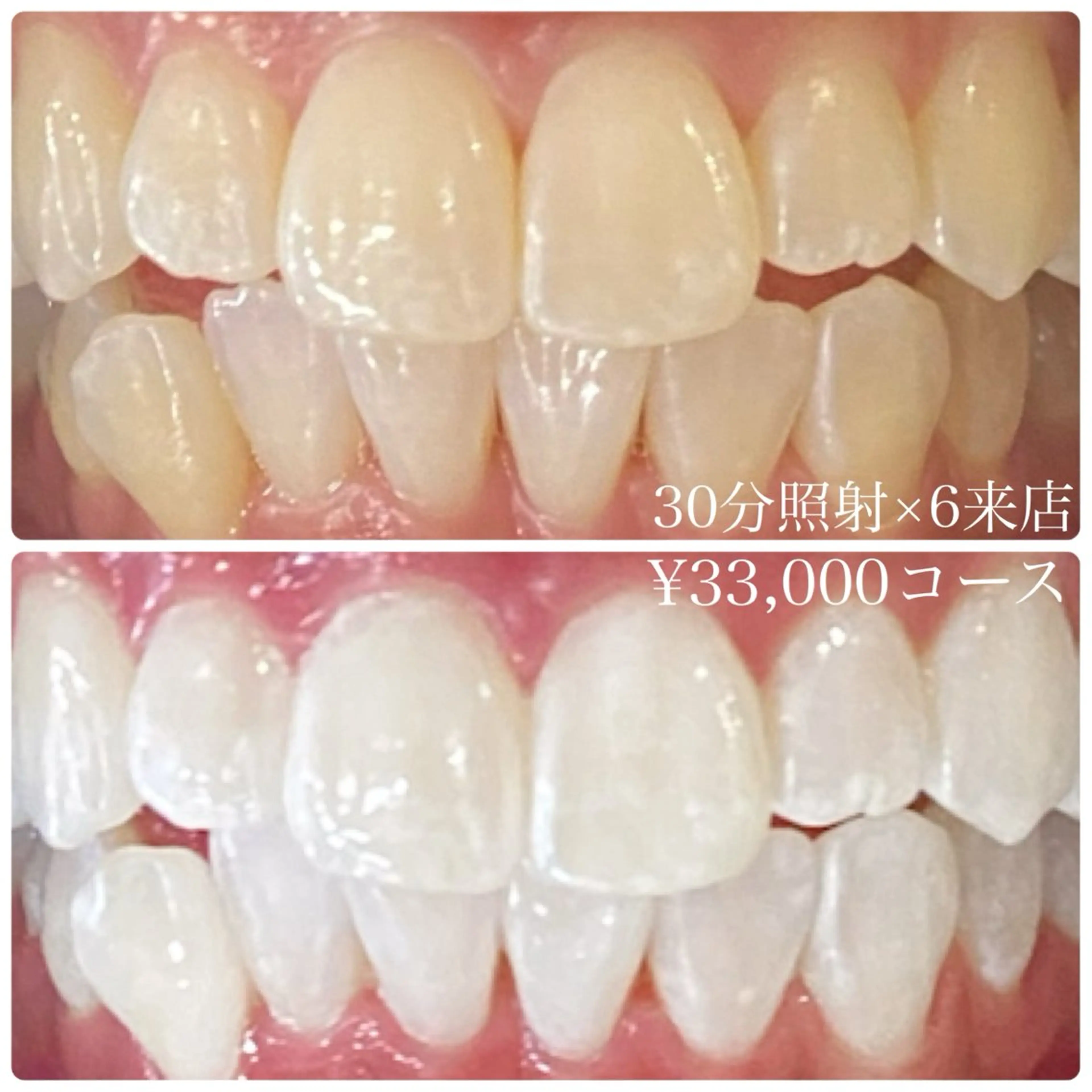 メンズ ホワイトニングルーム　川崎店所属・ホワイトニング ルーム　川崎店のその他イメージ