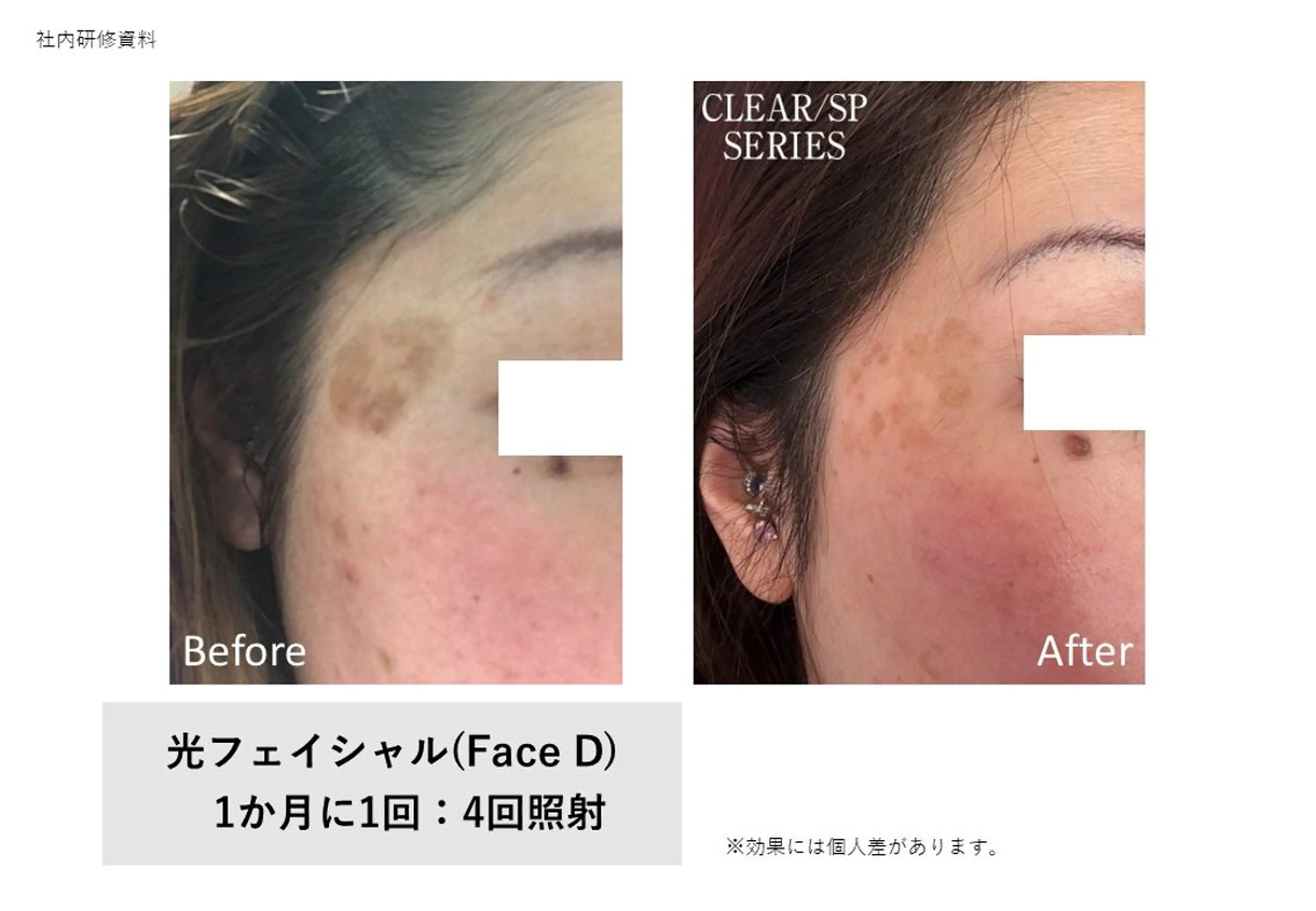 脱毛×肌質改善 M Mondoのエステ・リラクイメージ