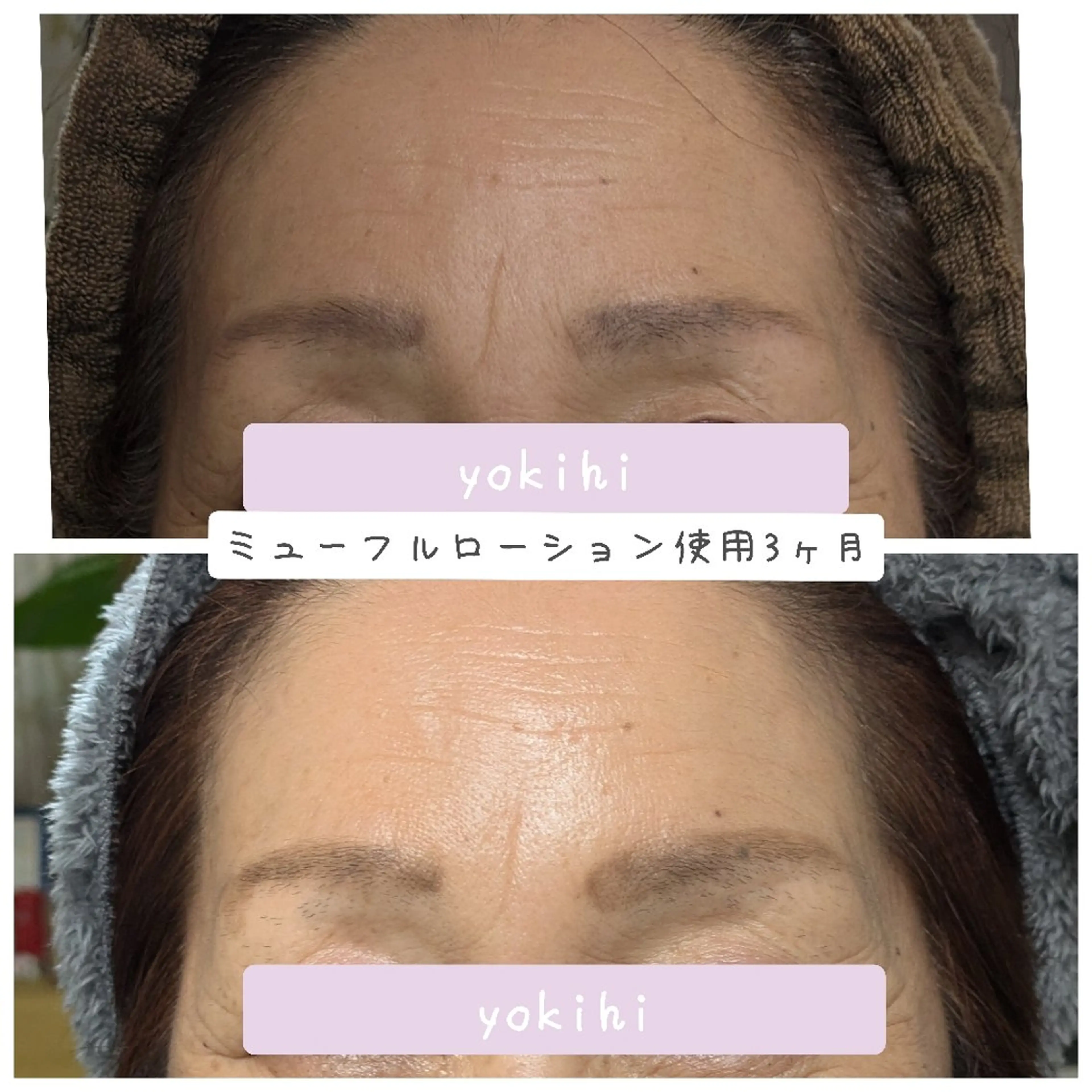 結果が出るスキンケア 肌質改善/まつパのエステ・リラクイメージ