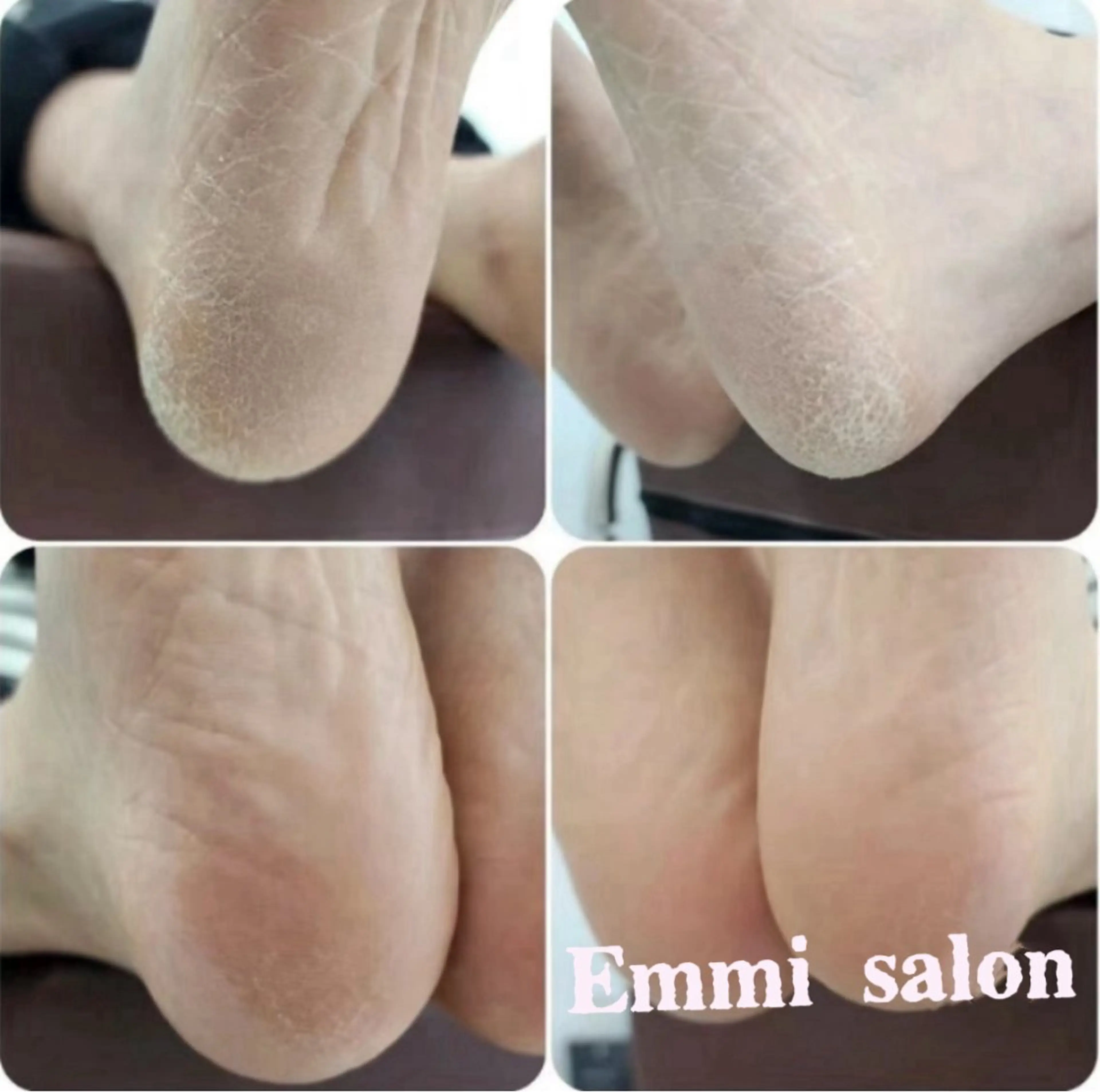 ネイル フットネイル Emmi salonのネイルデザイン