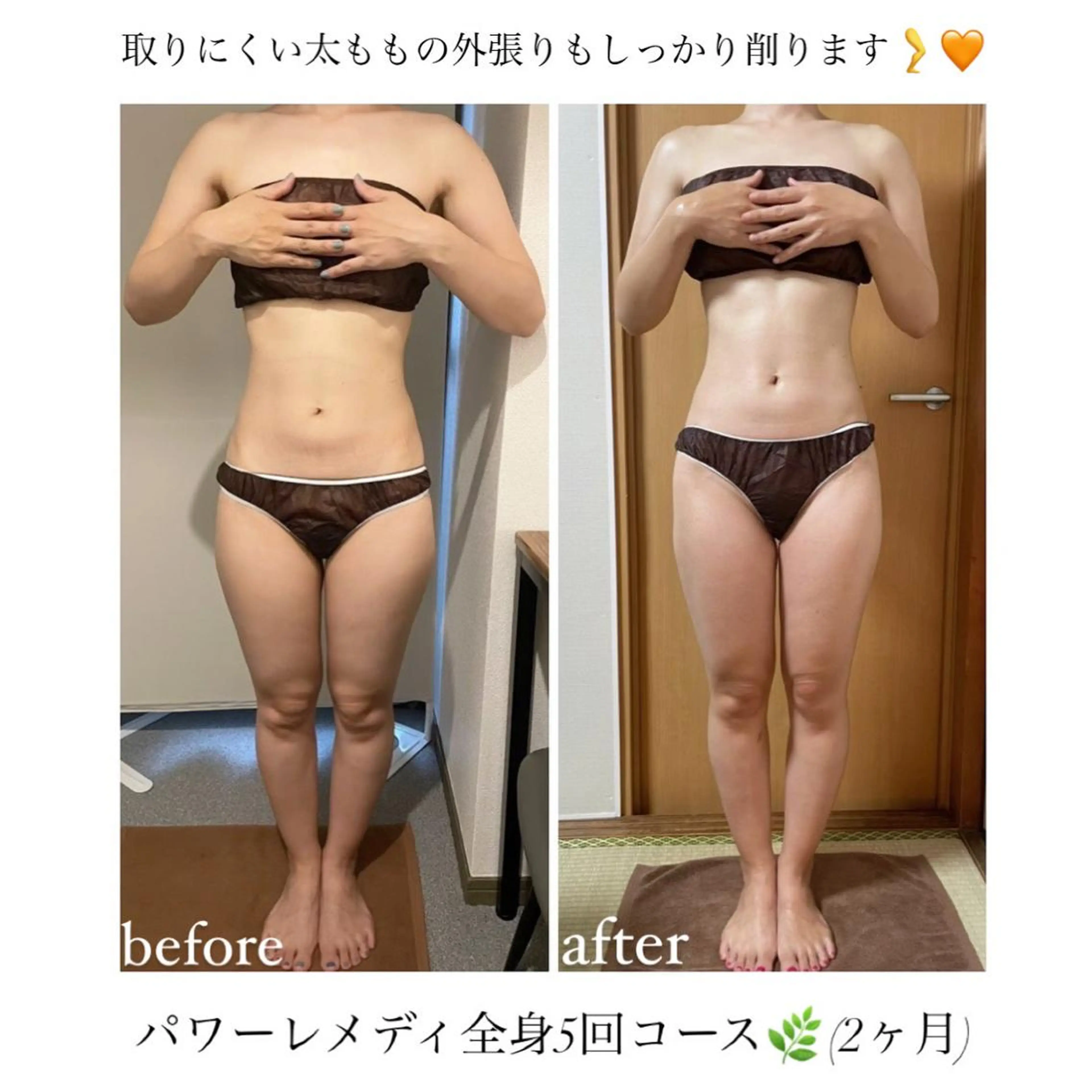 biloop所属・《本気痩せ×疲労改善 》  BILOOPのエステ・リラクイメージ