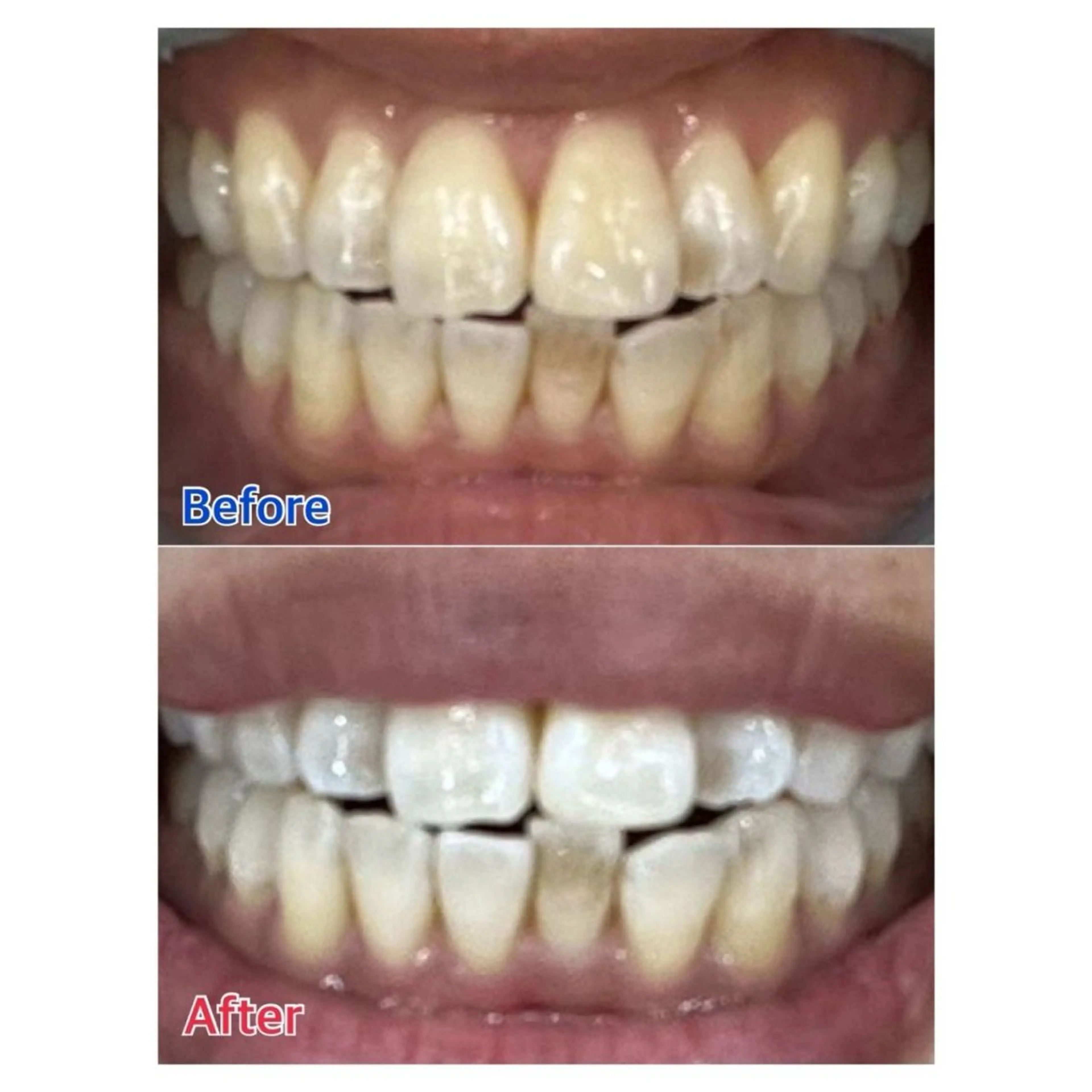 Melty 輝のその他イメージ