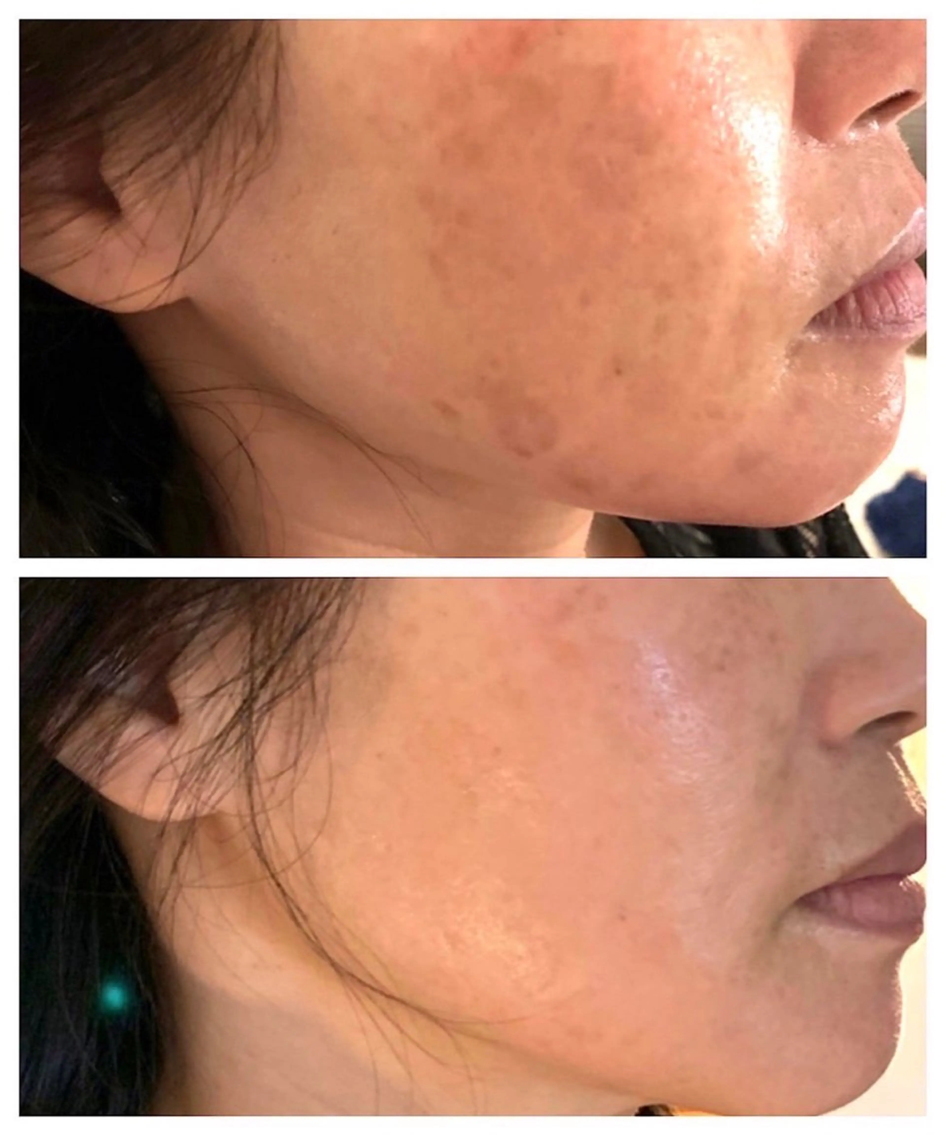 肌管理サロン neoriiのその他イメージ